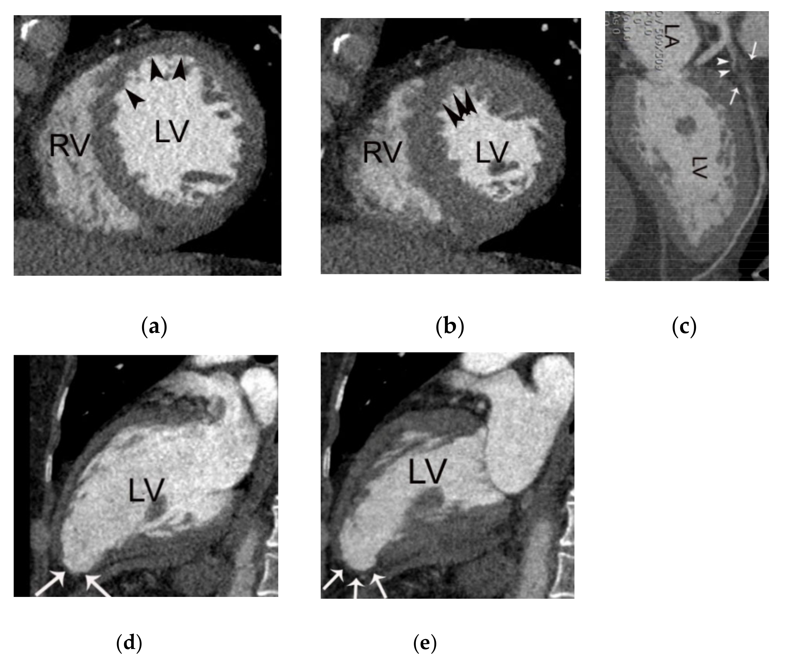 Diagnostics 11 00266 g007 Diagnostics 11 00266 g007