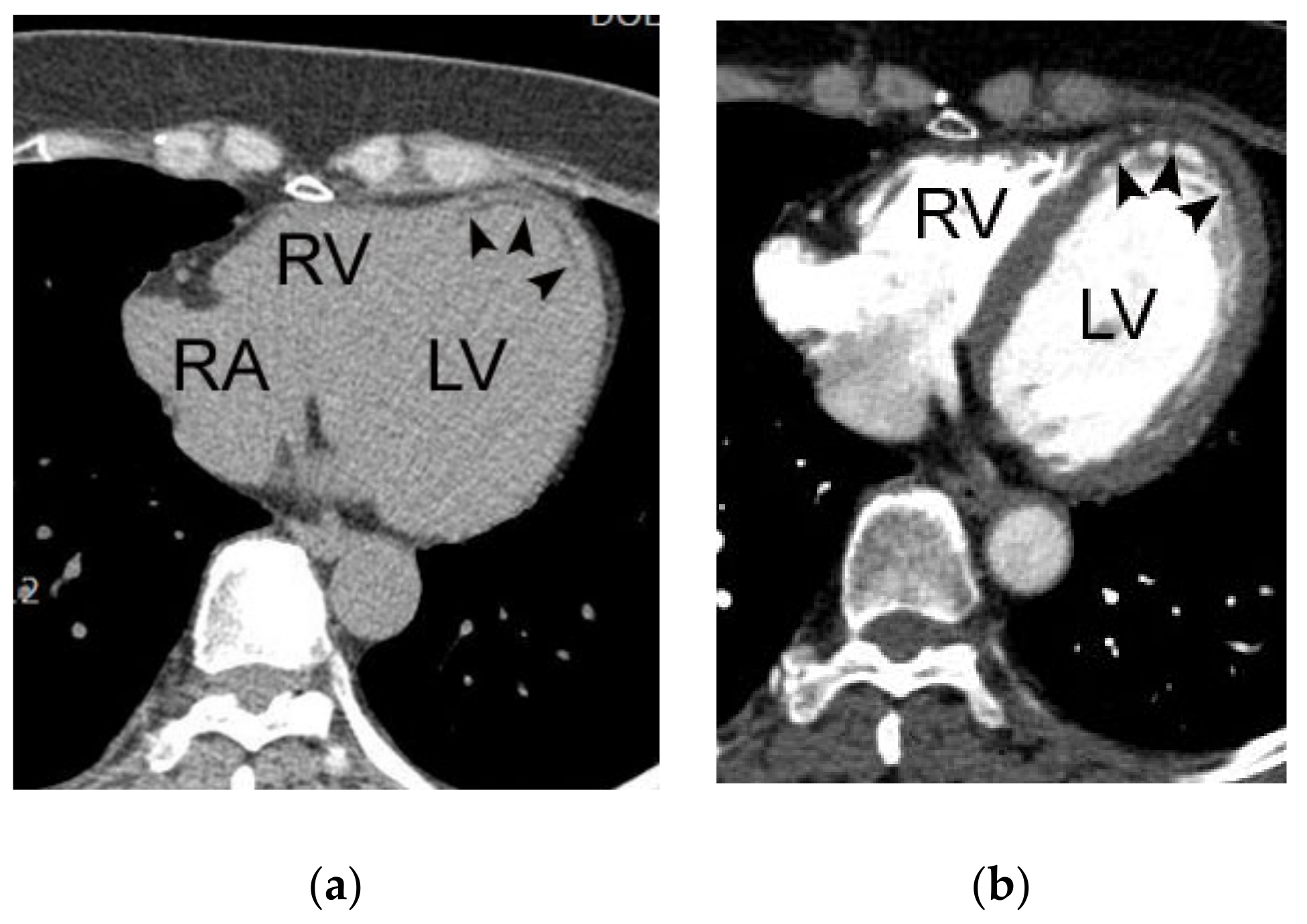 Diagnostics 11 00266 g008 Diagnostics 11 00266 g008