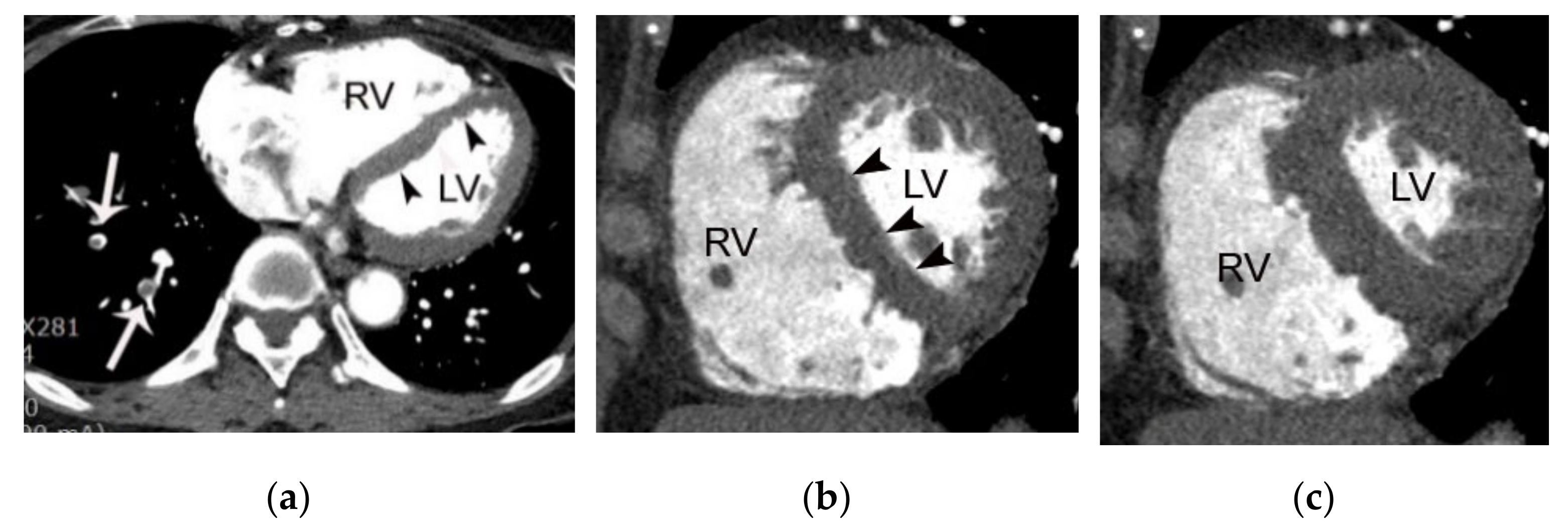 Diagnostics 11 00266 g011 Diagnostics 11 00266 g011
