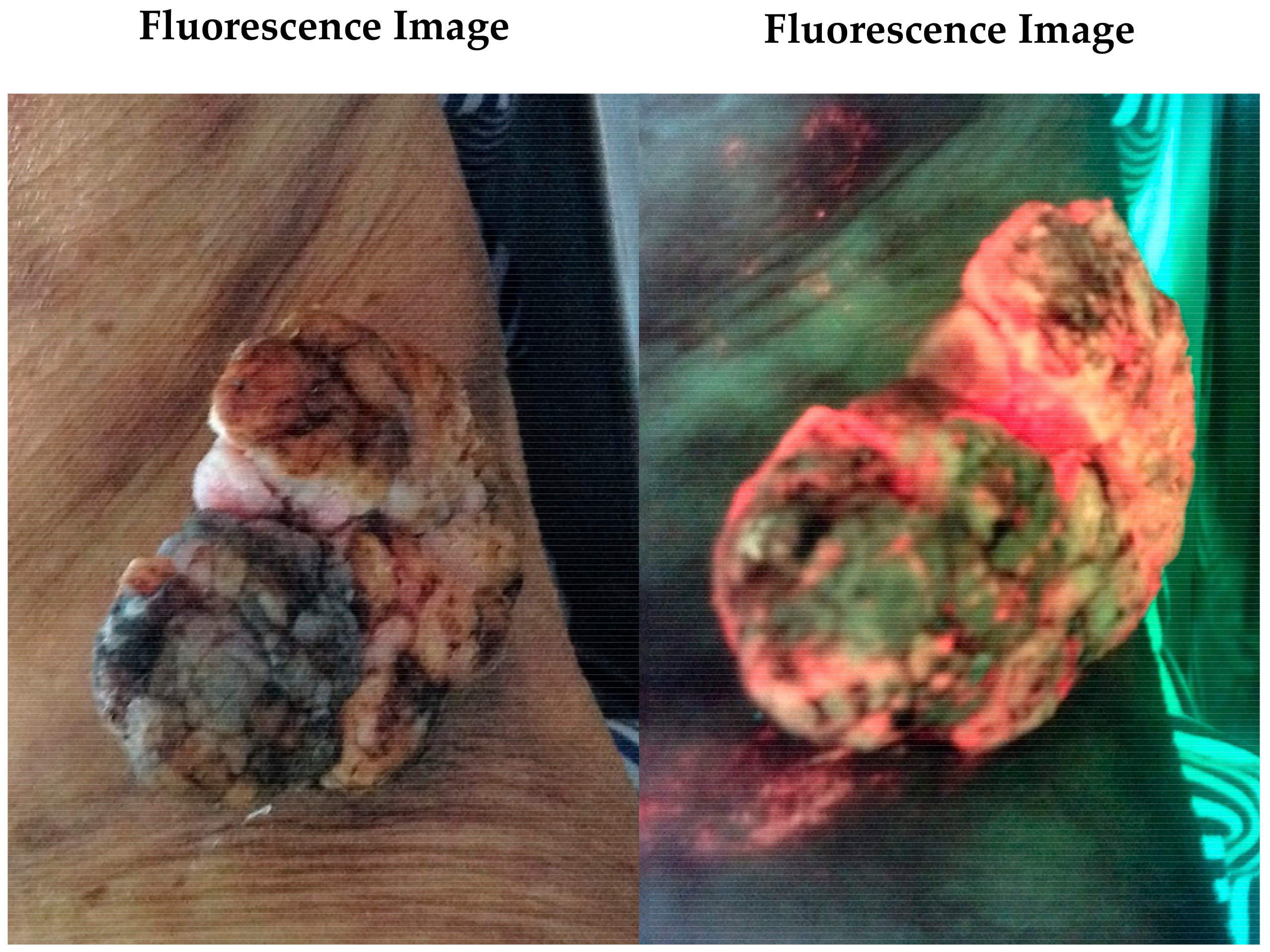 Diagnostics 11 00268 g003 Diagnostics 11 00268 g003