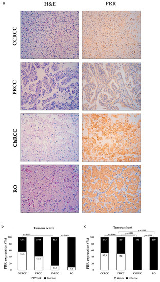 Diagnostics Free Full Text Clinical Implications Of Pro Renin Receptor Prr Expression In Renal Tumours Html