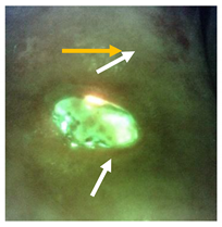 Diagnostics 11 00280 i003 Diagnostics 11 00280 i003