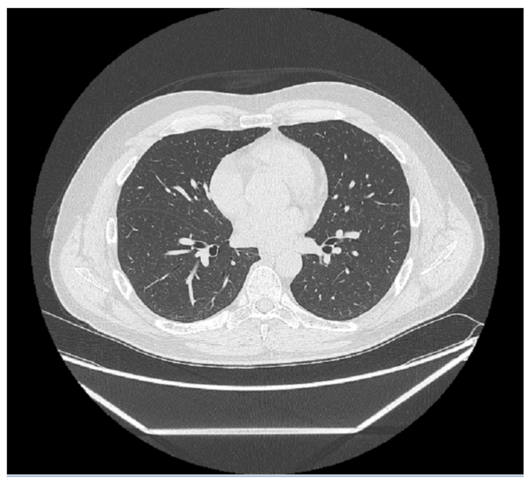 Diagnostics 11 00293 g005