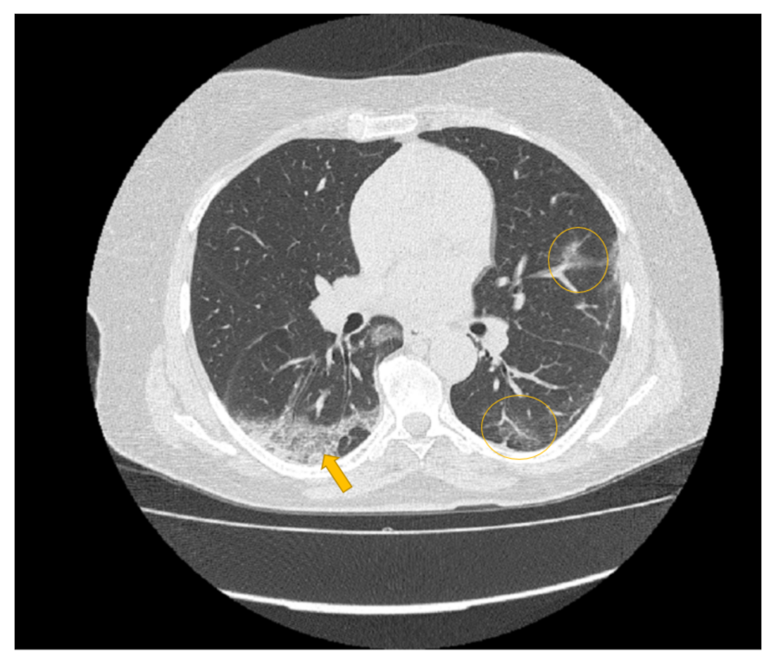Diagnostics 11 00293 g006