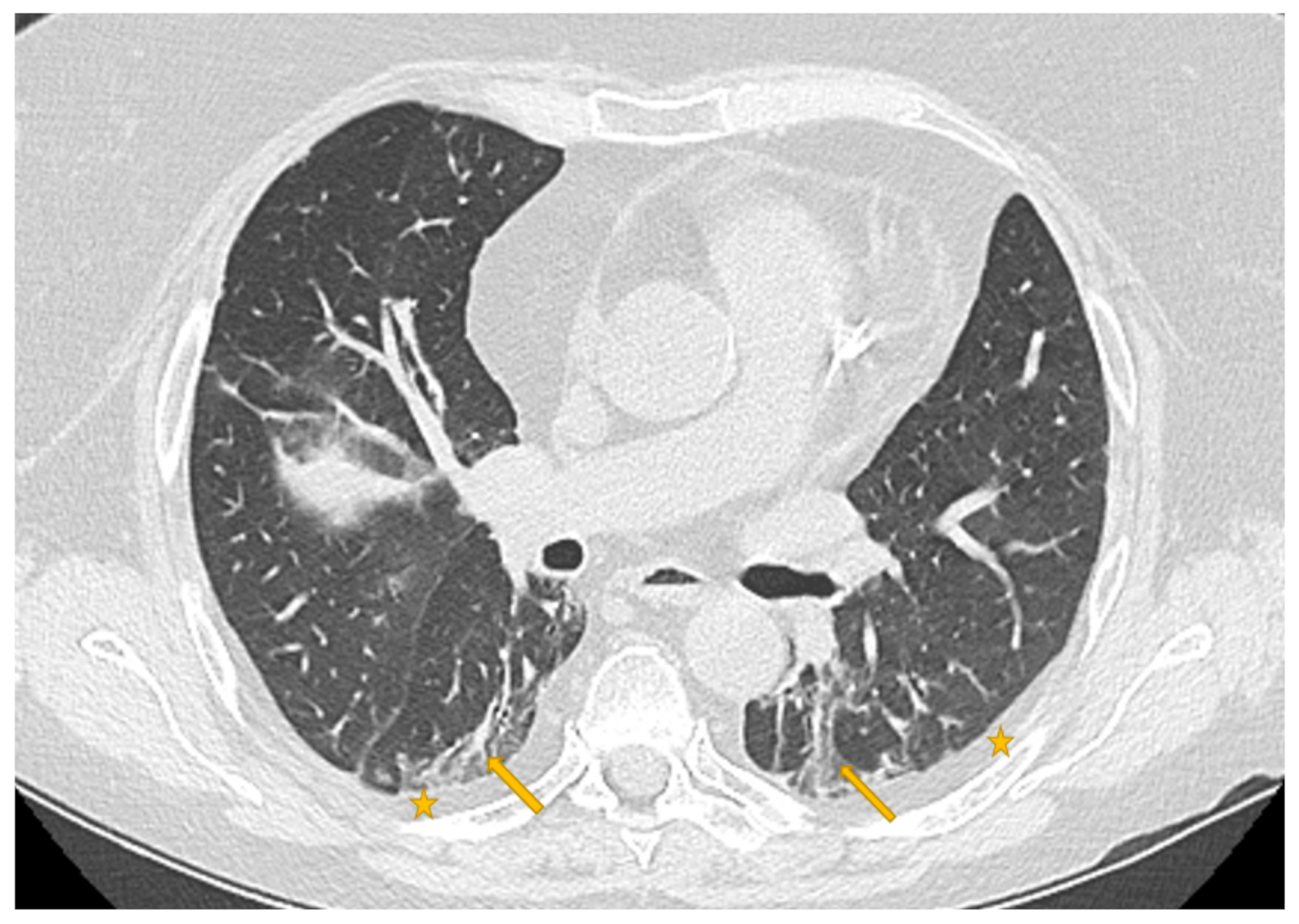 Diagnostics 11 00293 g007