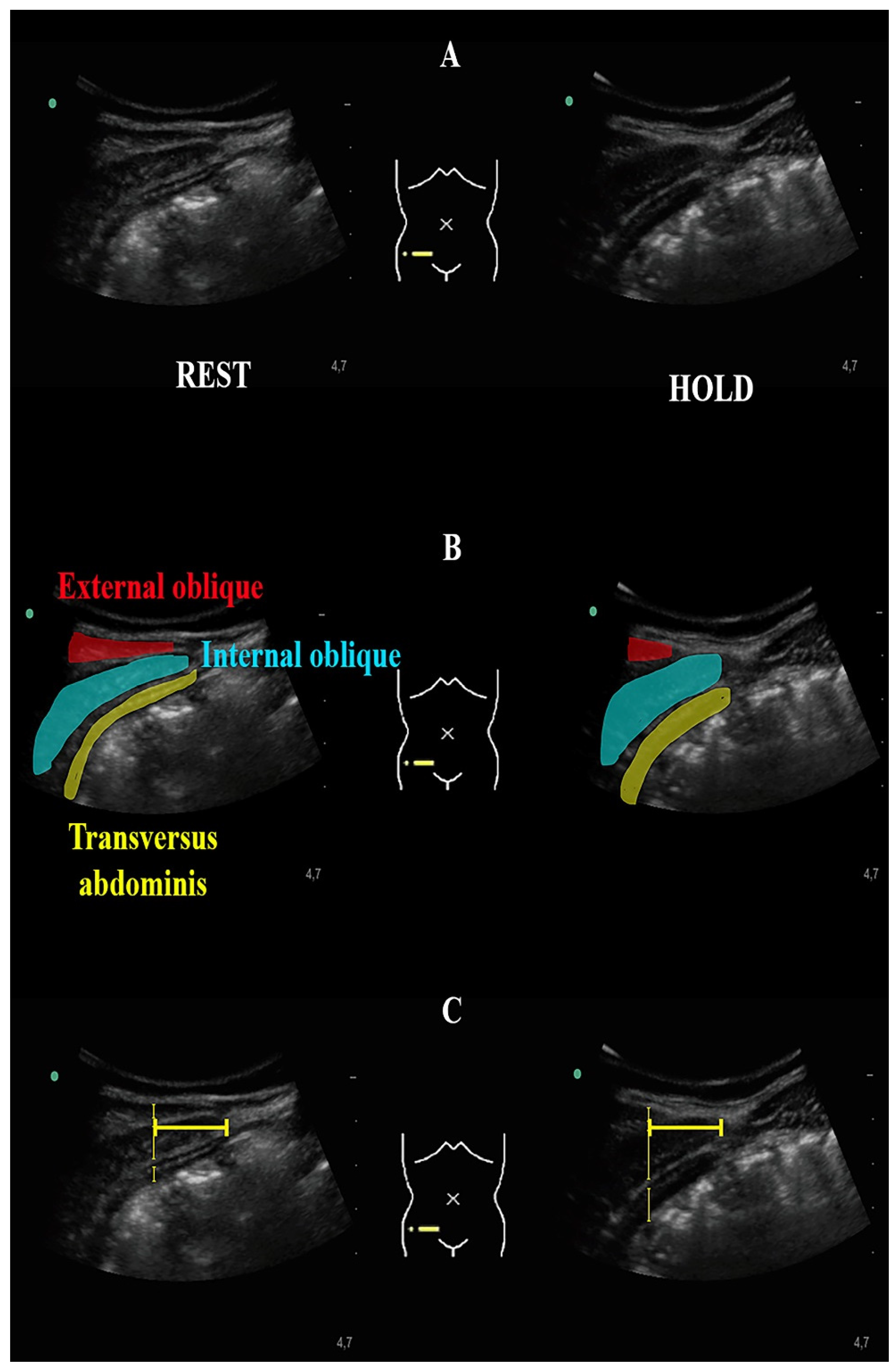 Diagnostics 11 00298 g002