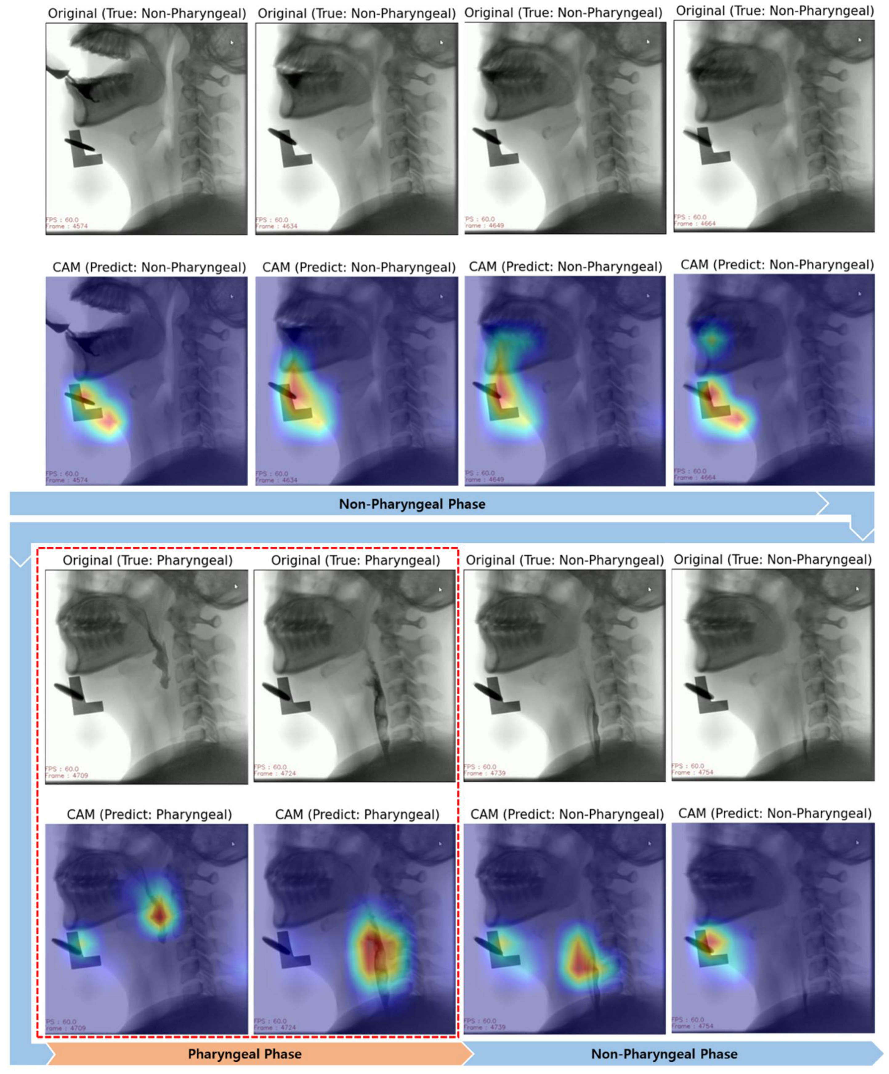 Diagnostics 11 00300 g009 Diagnostics 11 00300 g009