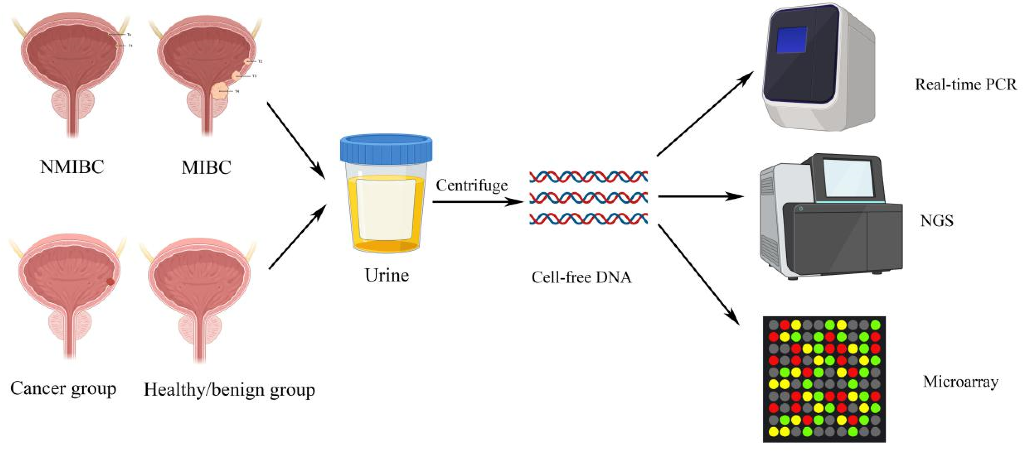 Urinary CellFree DNA in Bladder Cancer Detection Urinary CellFree DNA in Bladder Cancer Detection