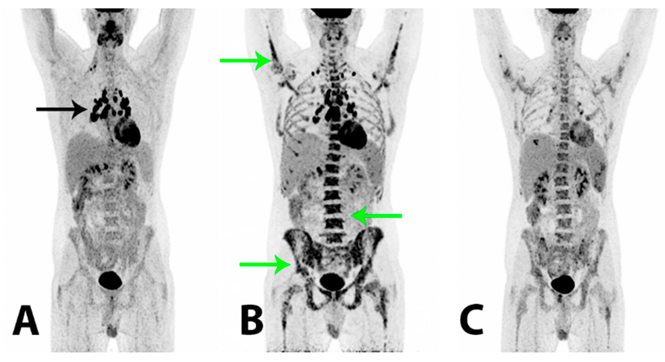 Diagnostics 11 00310 g004