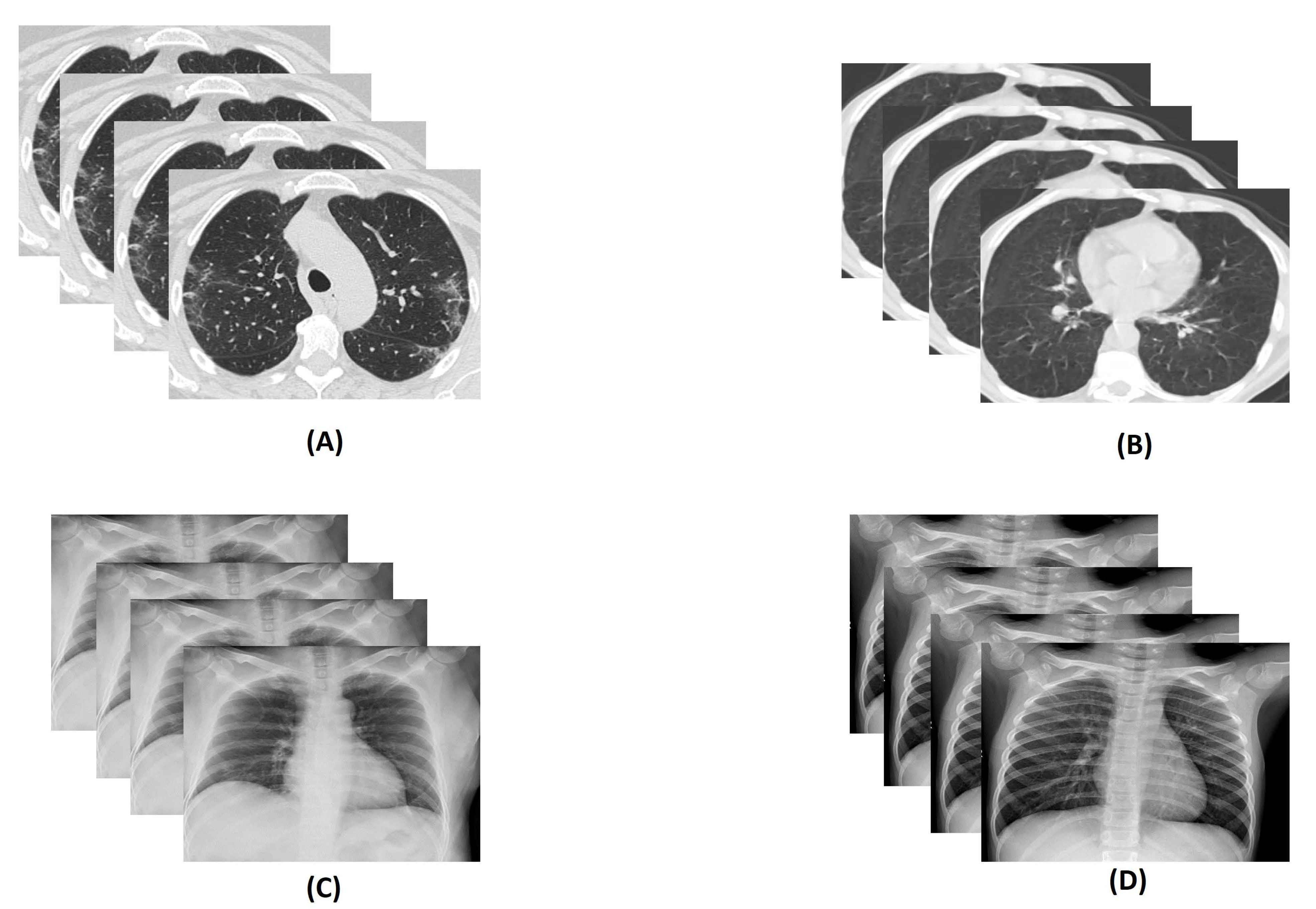Diagnostics 11 00315 g002