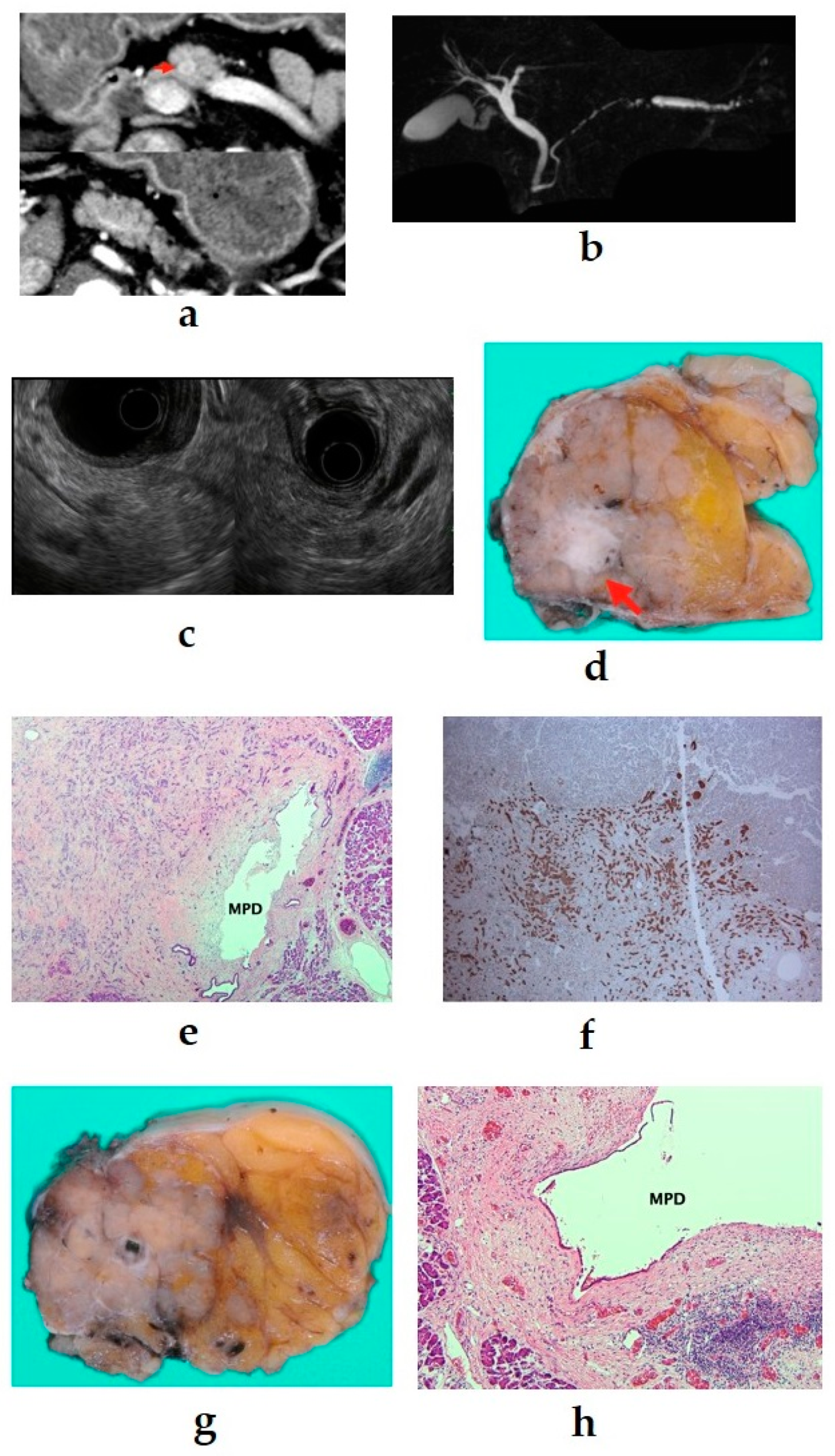Diagnostics 11 00316 g004