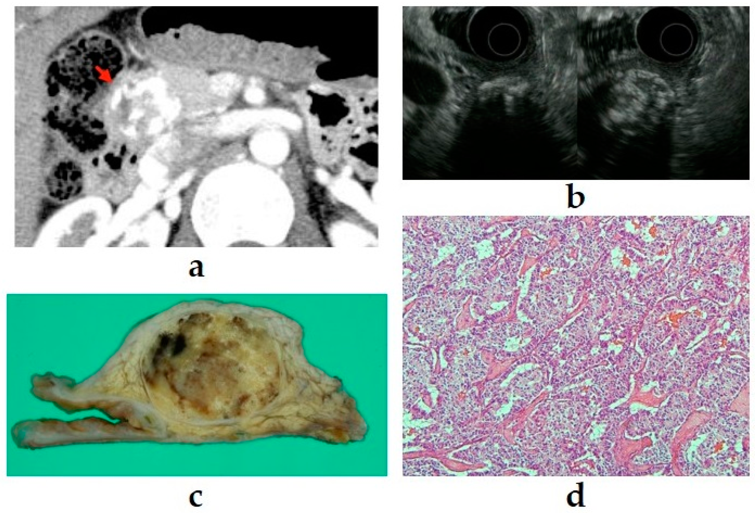 Diagnostics 11 00316 g006