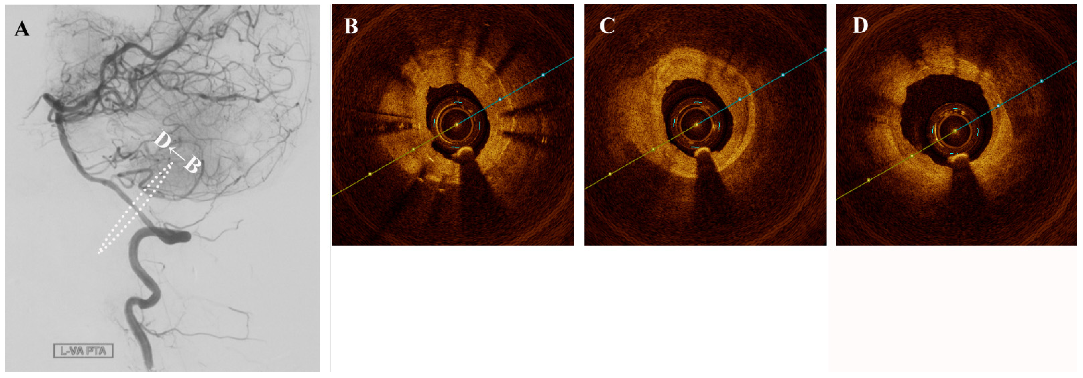 Diagnostics 11 00322 g002