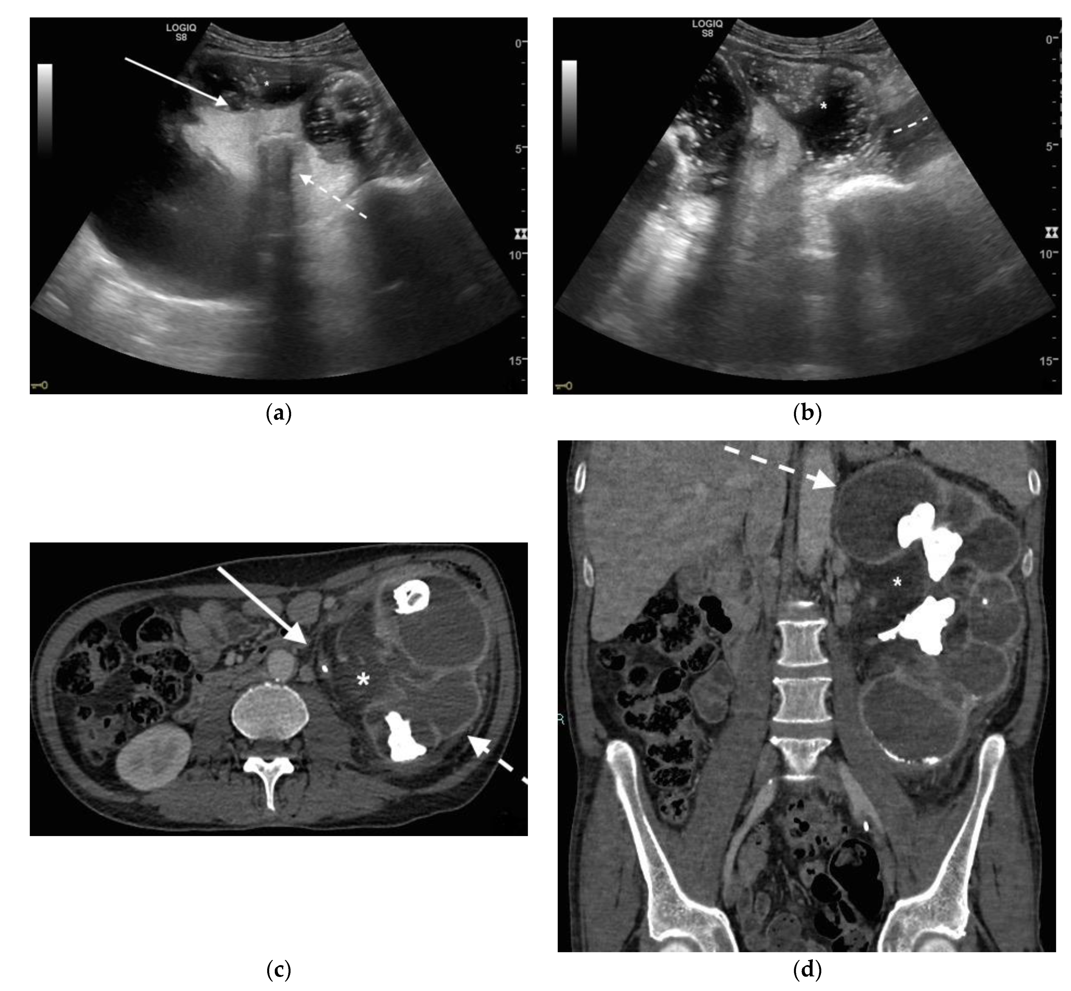 Diagnostics 11 00331 g002