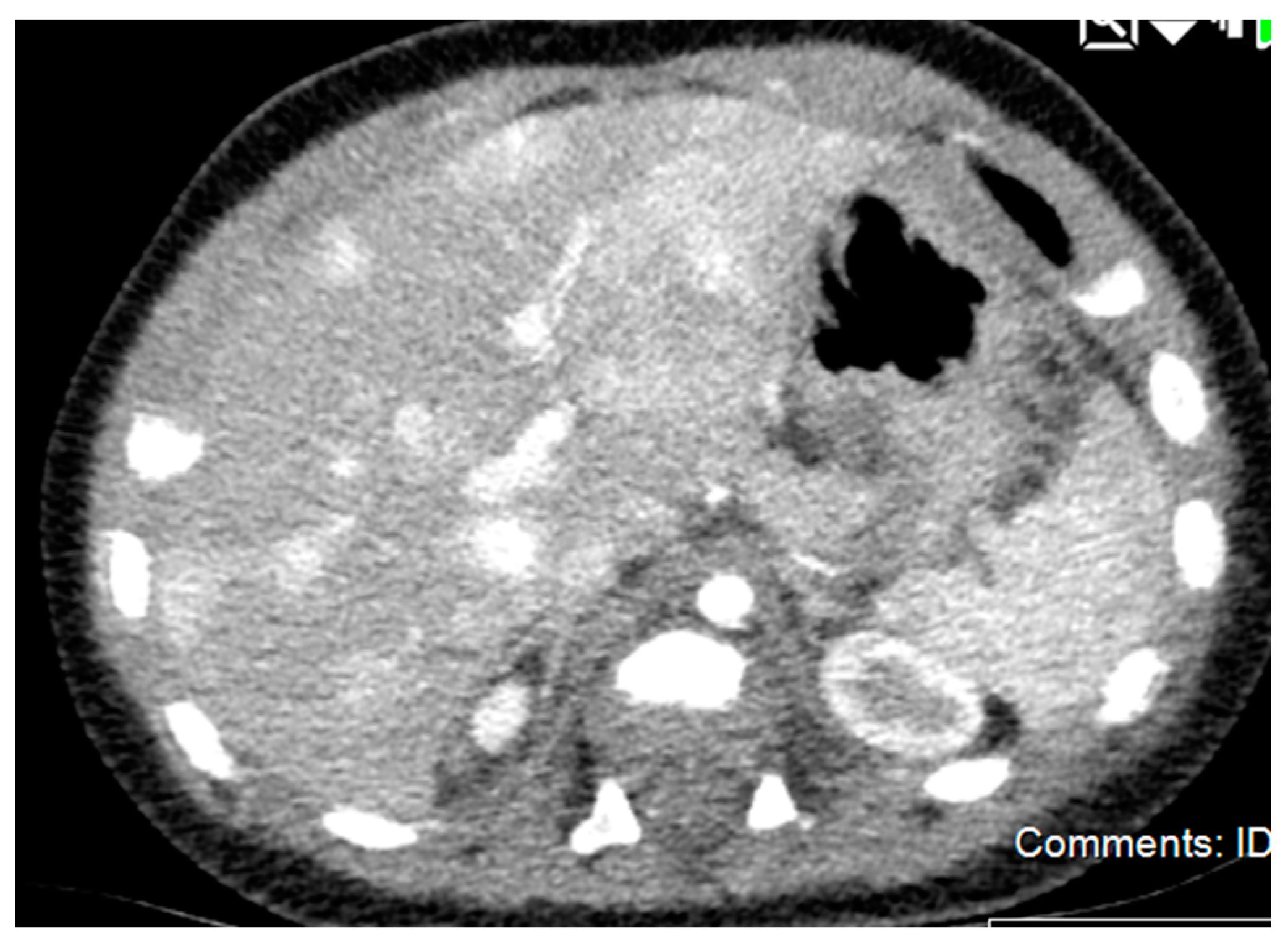 Diagnostics 11 00333 g002 Diagnostics 11 00333 g002