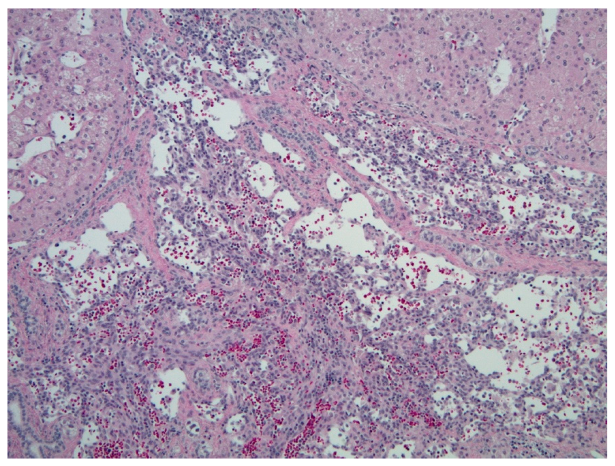 Diagnostics 11 00333 g003 Diagnostics 11 00333 g003