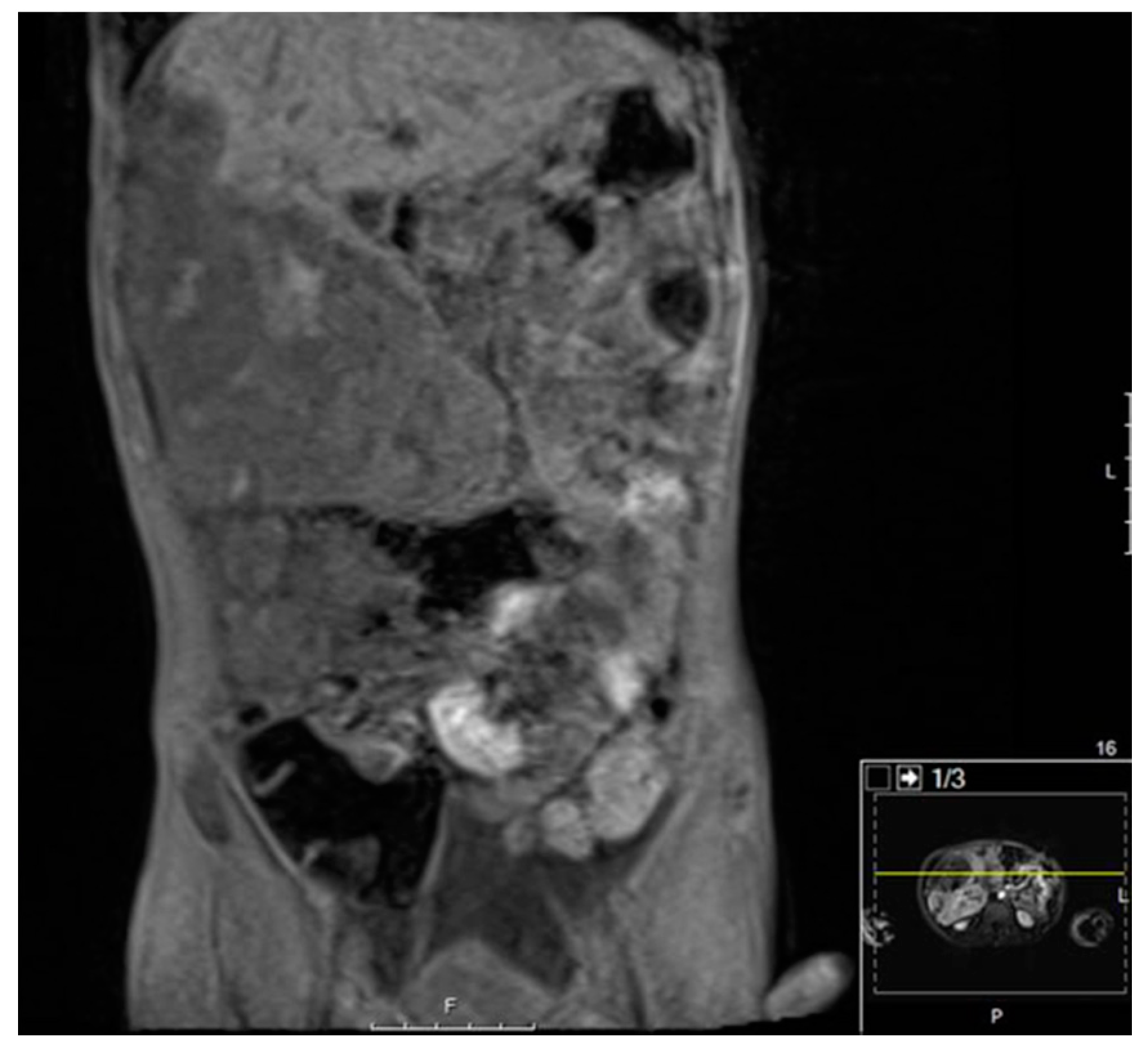 Diagnostics 11 00333 g005 Diagnostics 11 00333 g005