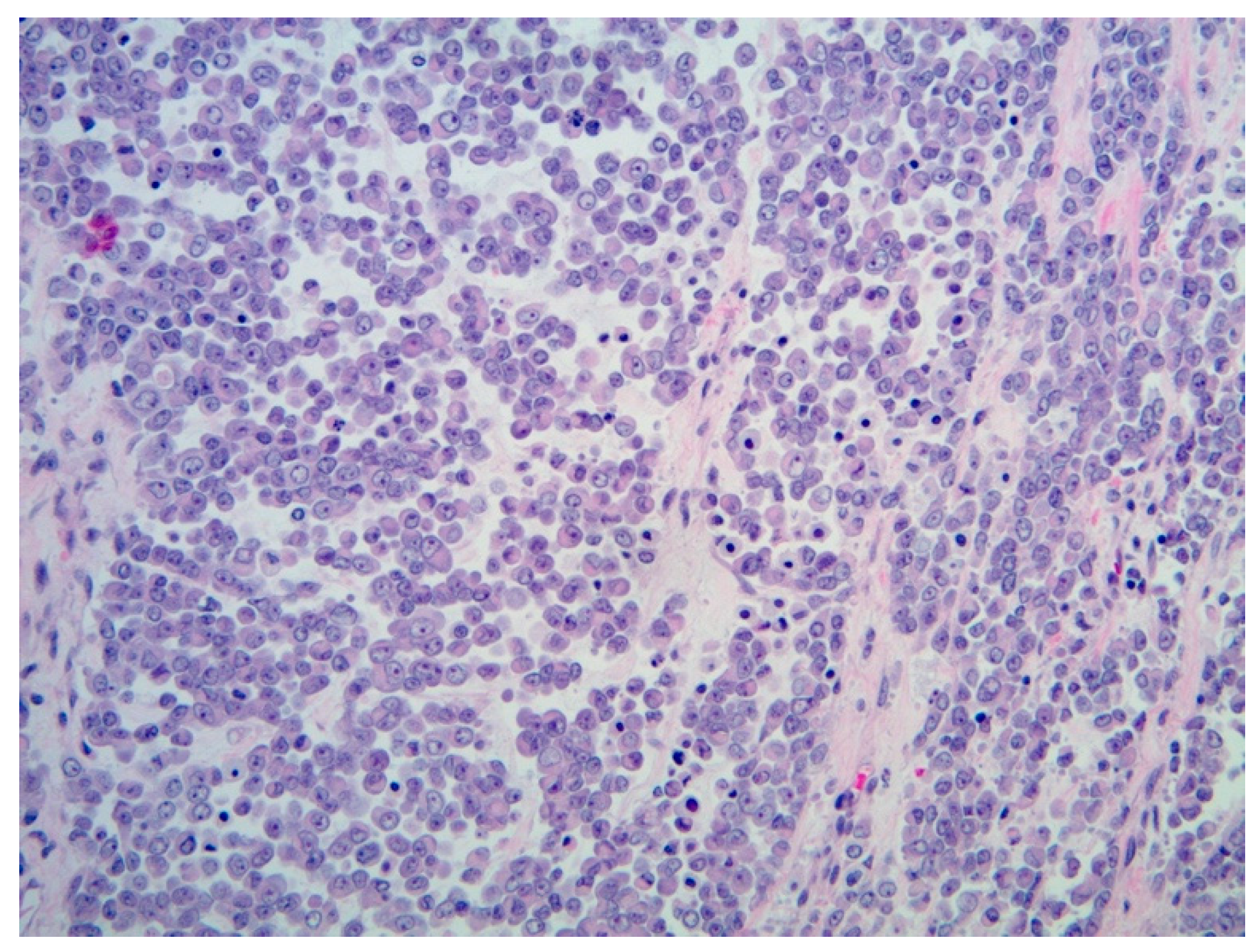 Diagnostics 11 00333 g007 Diagnostics 11 00333 g007