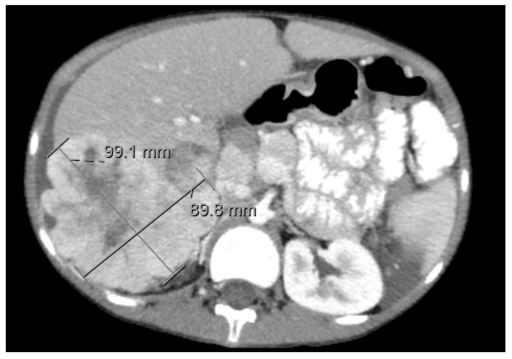 Diagnostics 11 00333 g010 Diagnostics 11 00333 g010