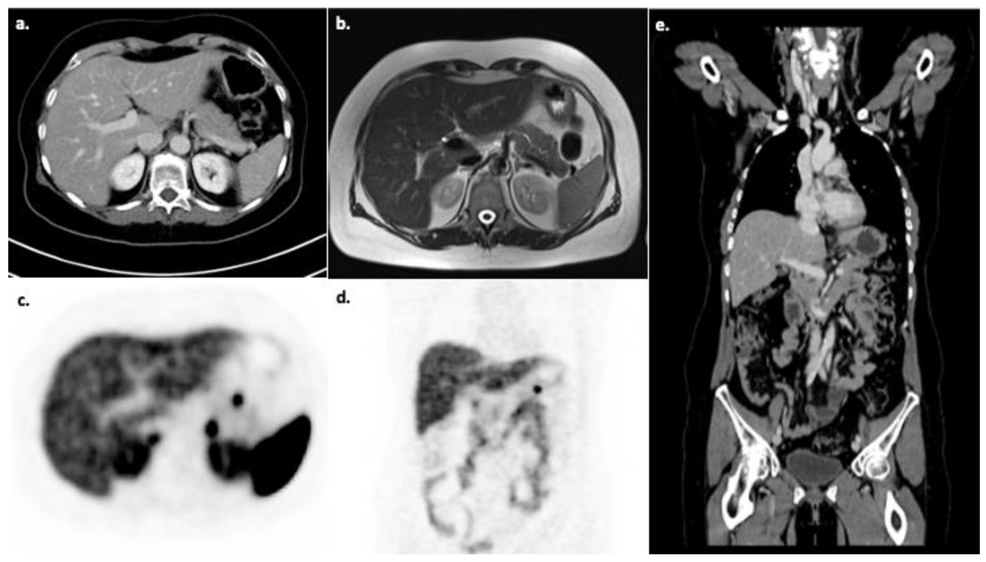 Diagnostics 11 00334 g005 Diagnostics 11 00334 g005