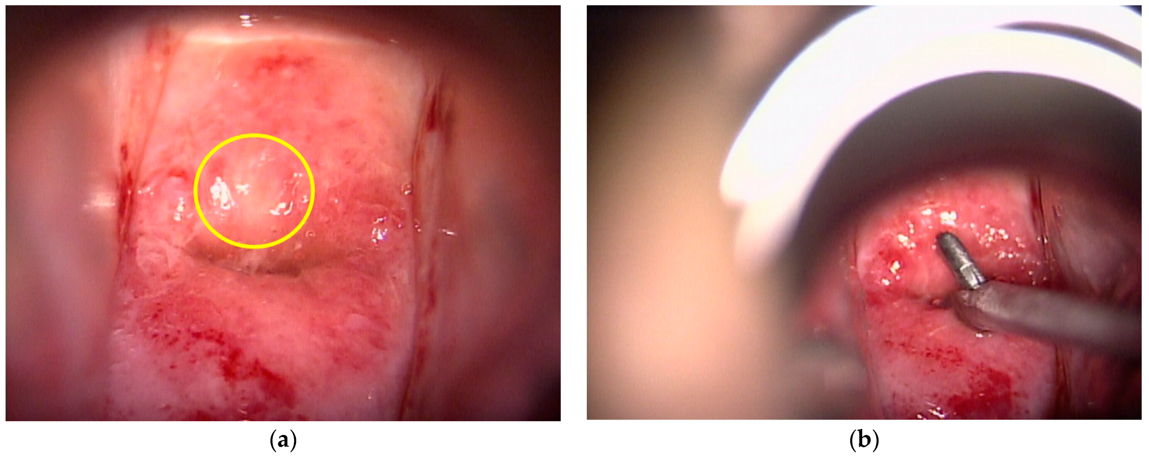 Diagnostics 11 00360 g002 Diagnostics 11 00360 g002