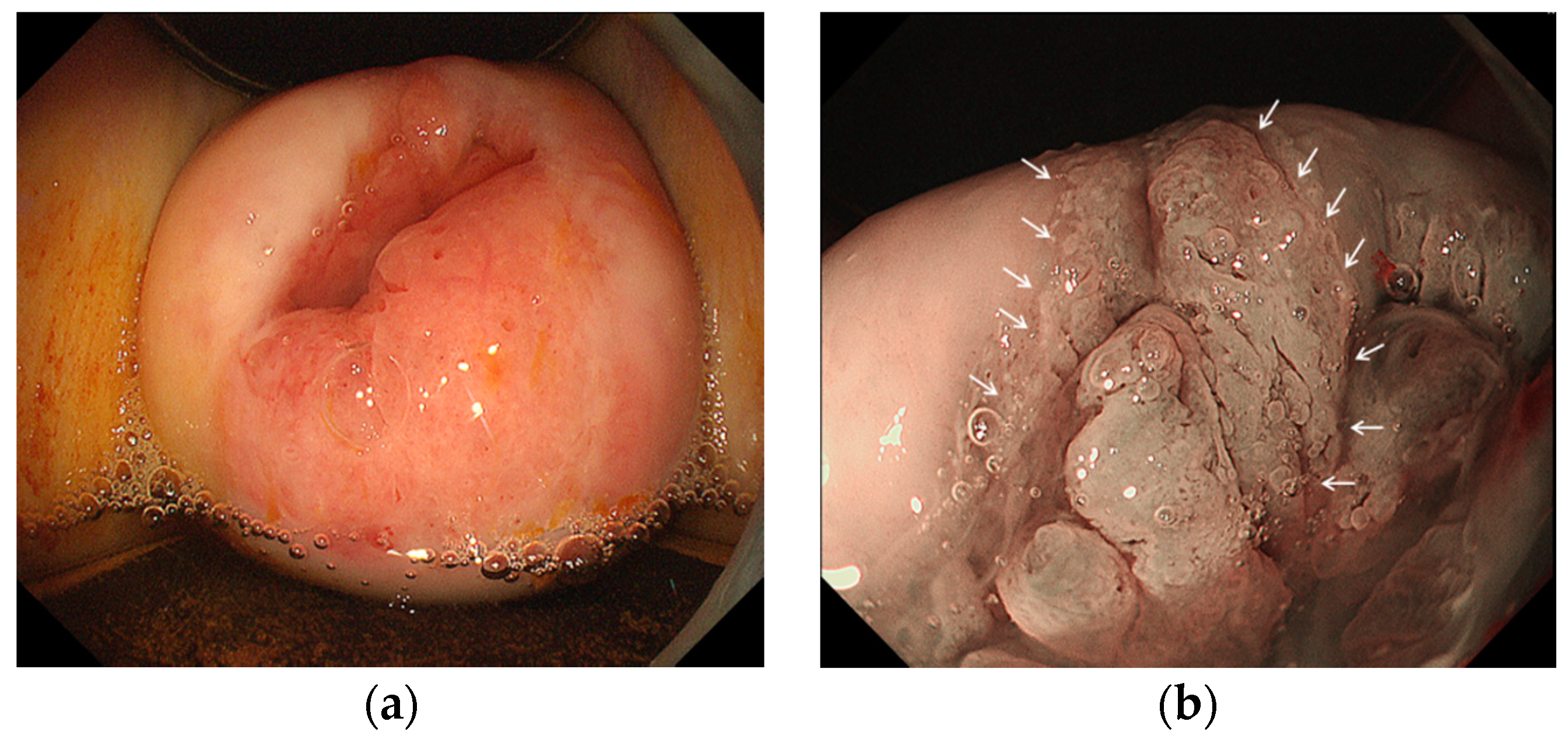 Diagnostics 11 00360 g003 Diagnostics 11 00360 g003