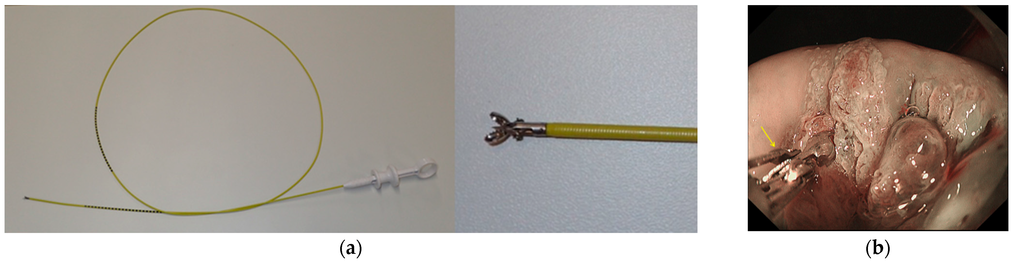 Diagnostics 11 00360 g004 Diagnostics 11 00360 g004