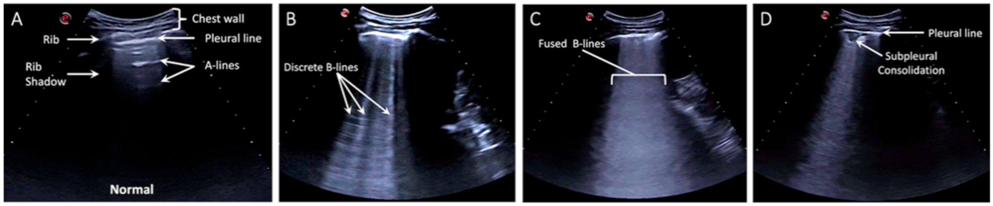 Diagnostics 11 00373 g002 Diagnostics 11 00373 g002