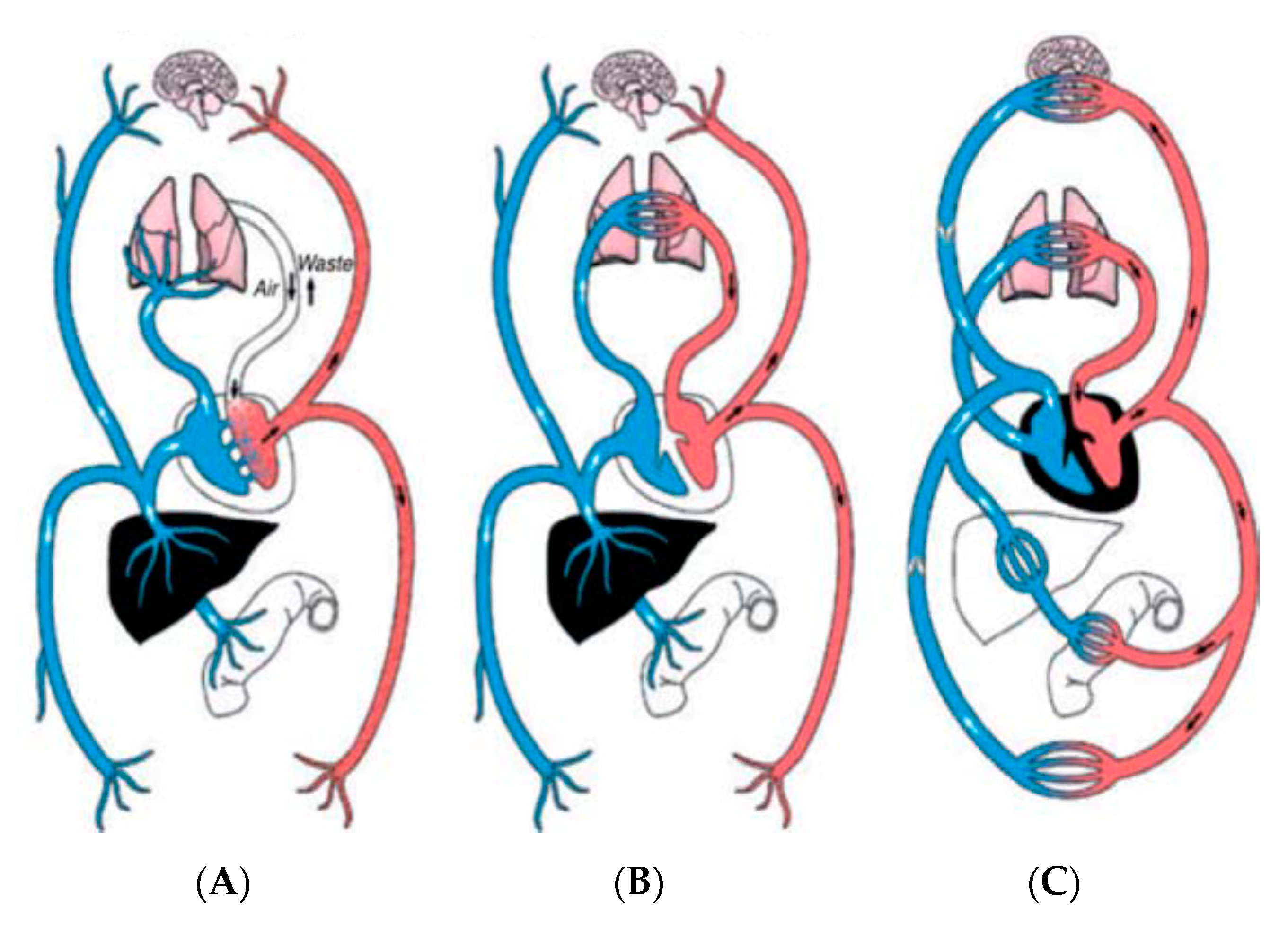 Diagnostics 11 00381 g001