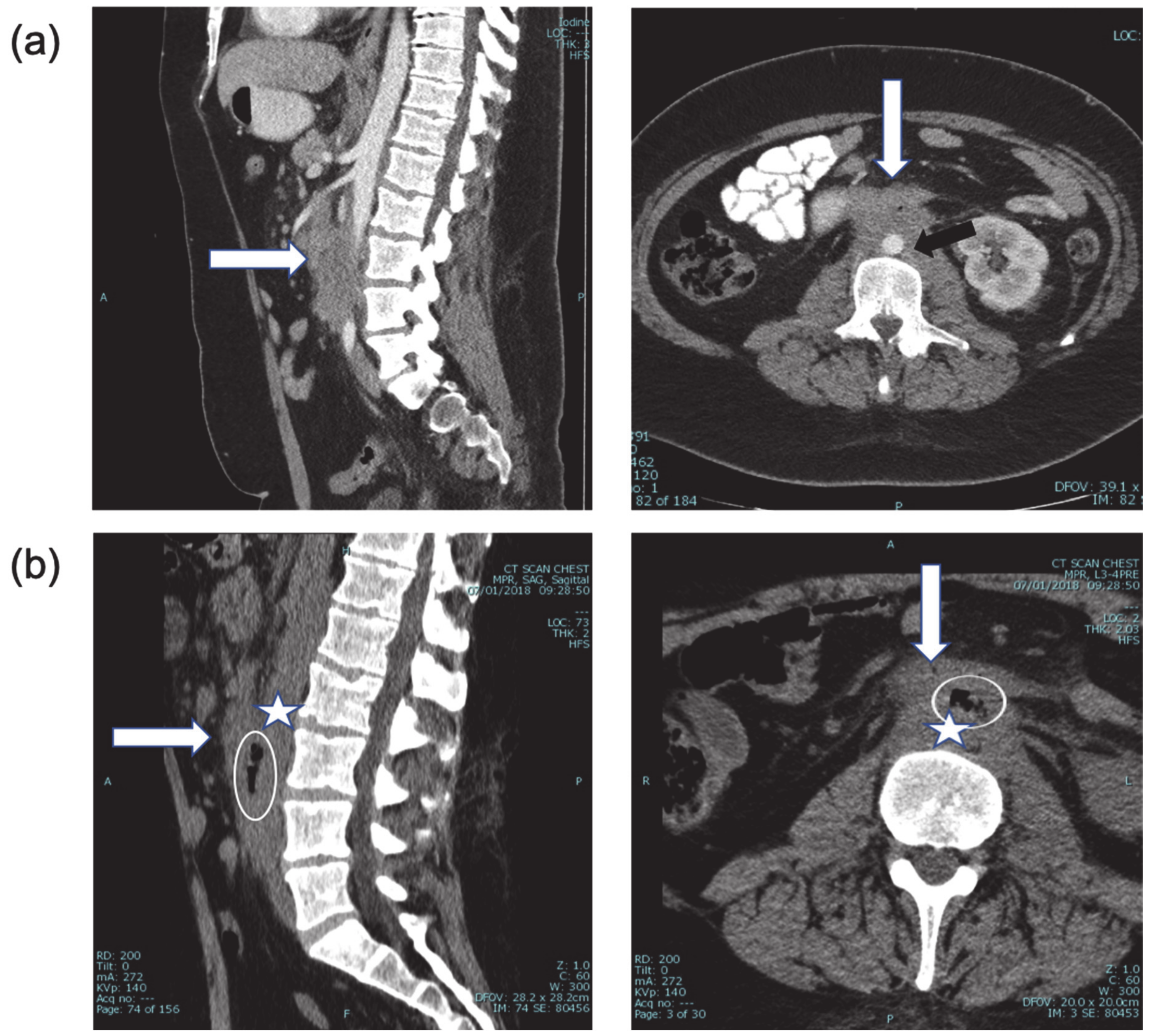 Diagnostics 11 00389 g001
