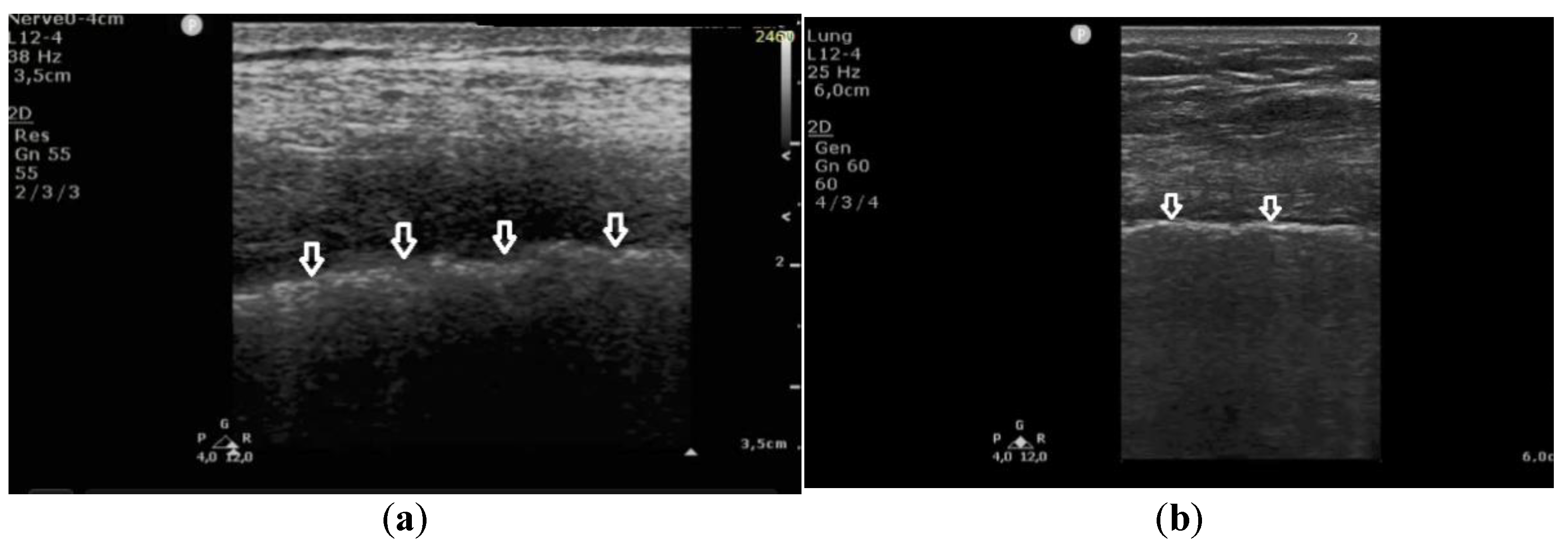 Diagnostics 11 00401 g003