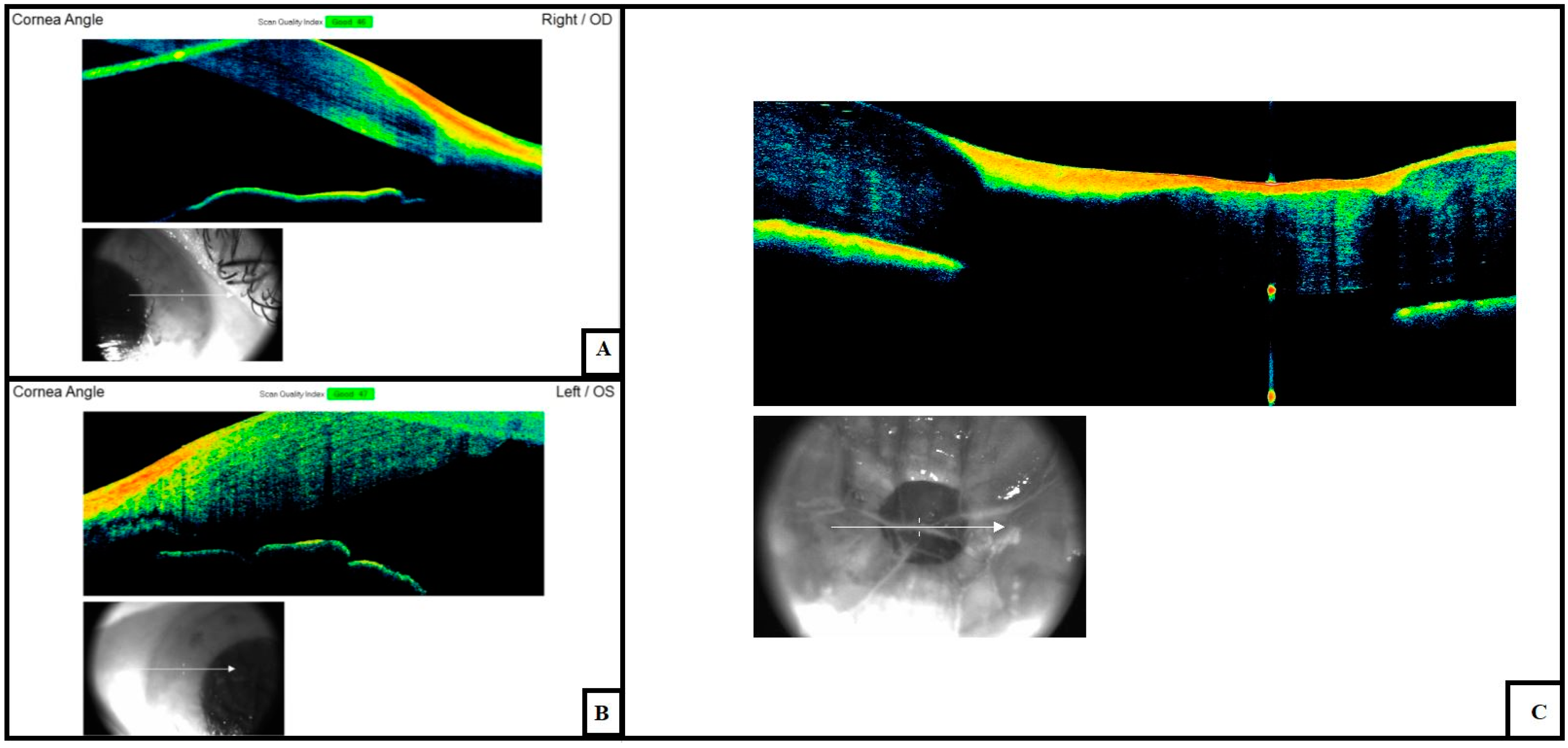 Diagnostics 11 00413 g004 Diagnostics 11 00413 g004