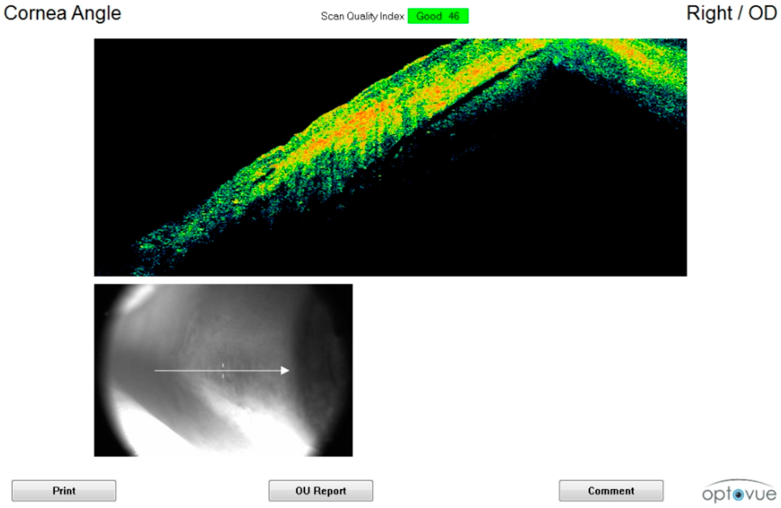Diagnostics 11 00413 g005 Diagnostics 11 00413 g005