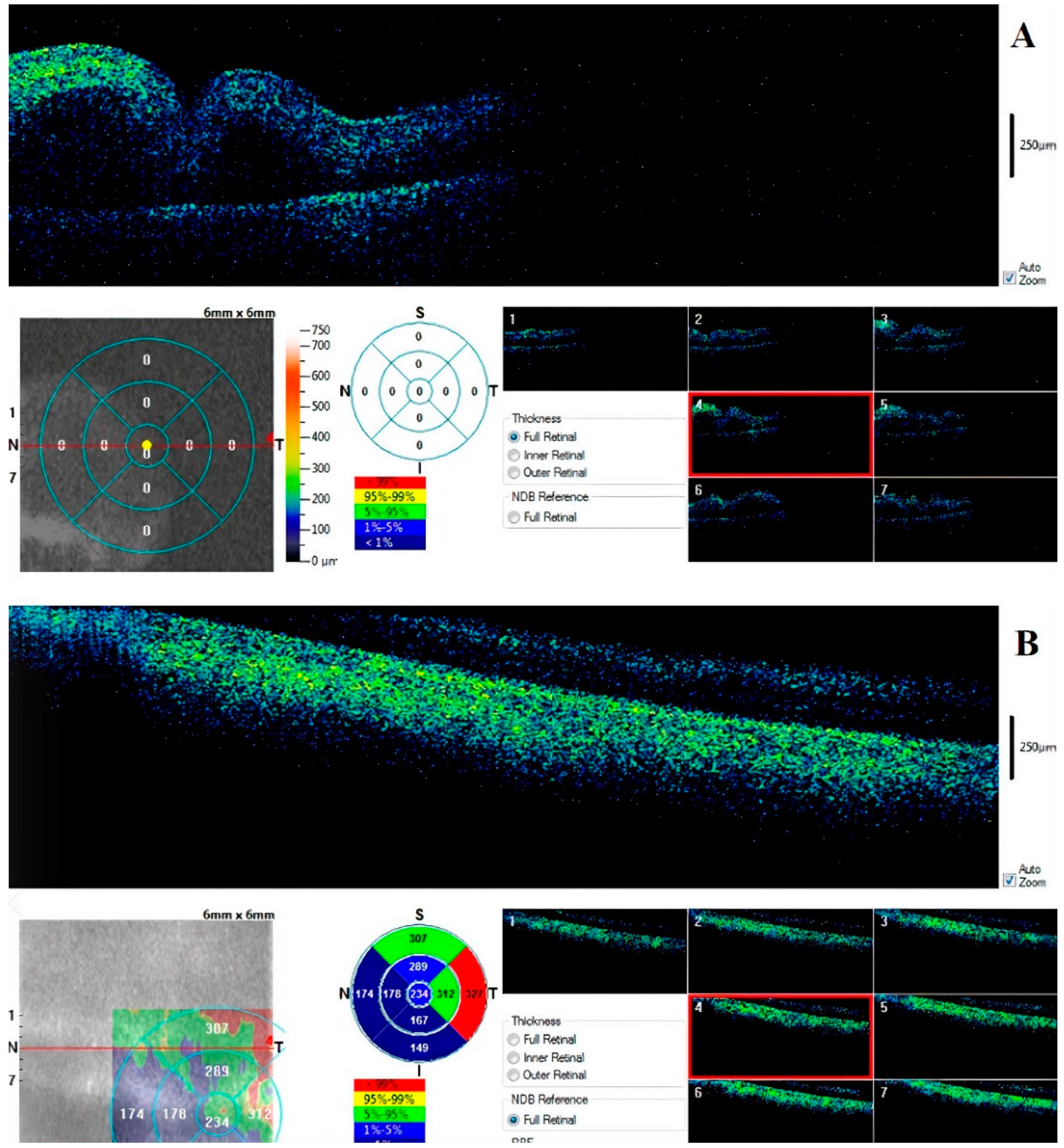 Diagnostics 11 00413 g006 Diagnostics 11 00413 g006