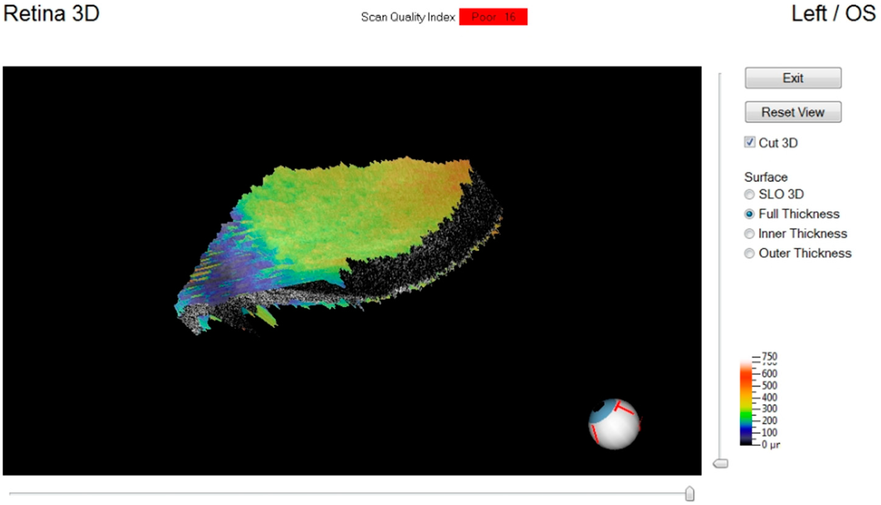 Diagnostics 11 00413 g007 Diagnostics 11 00413 g007