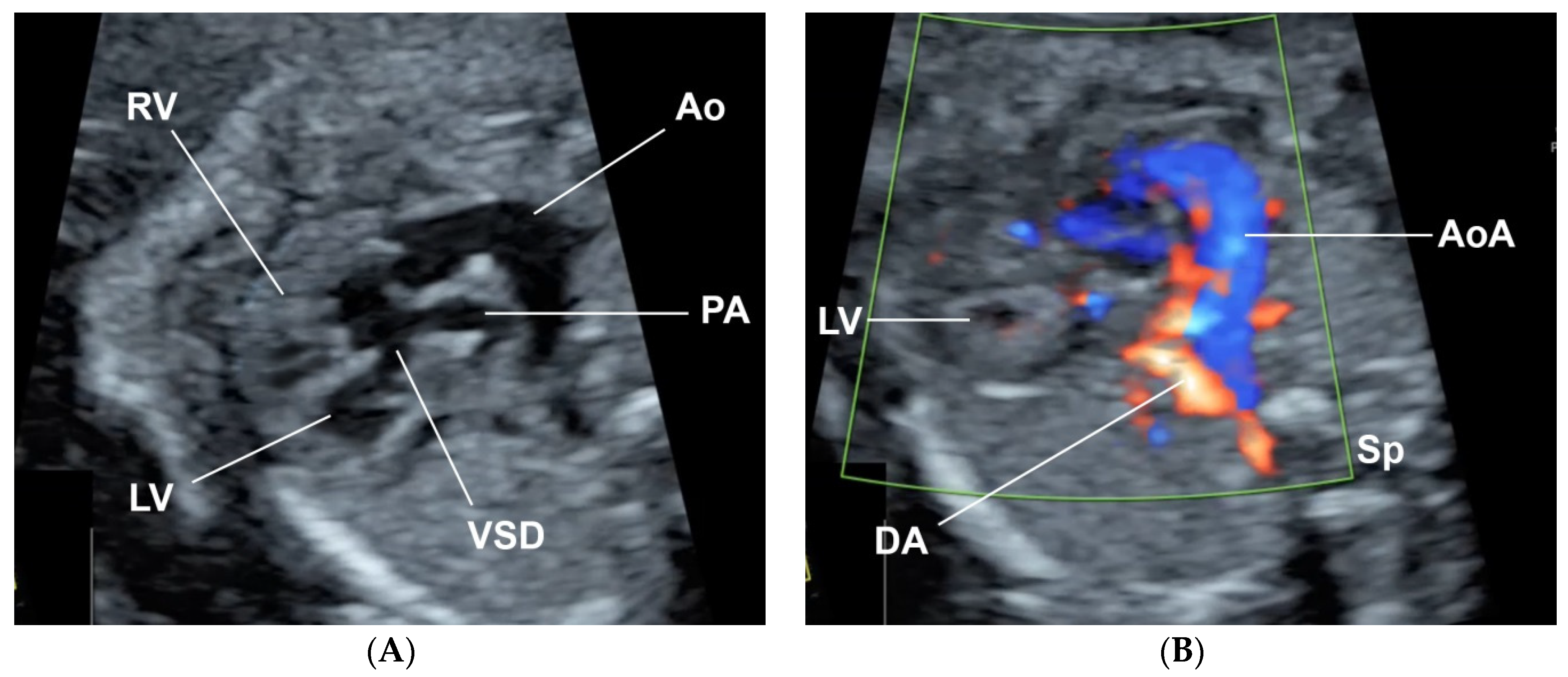 Diagnostics 11 00415 g001