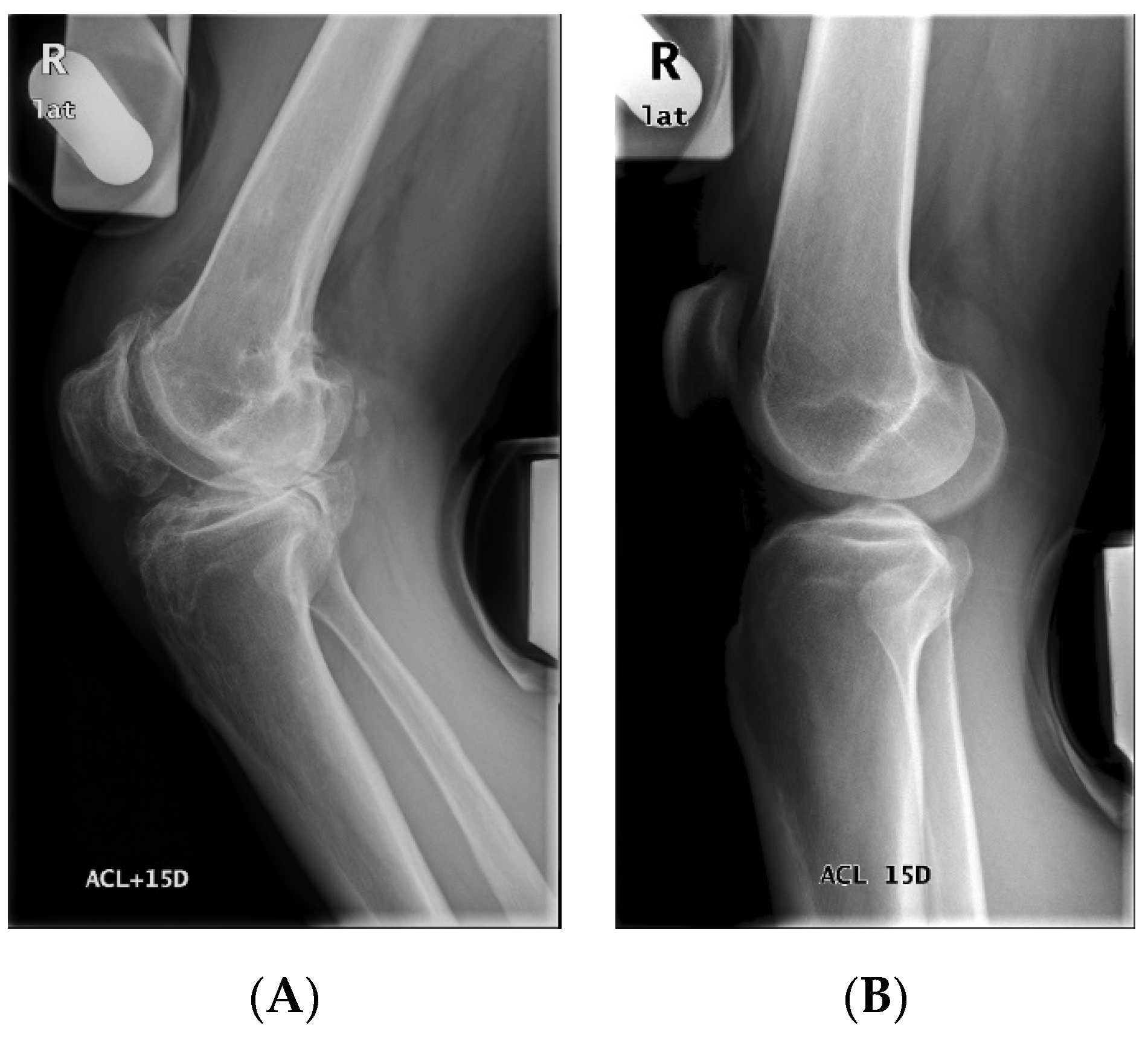 Diagnostics 11 00419 g0a1 Diagnostics 11 00419 g0a1