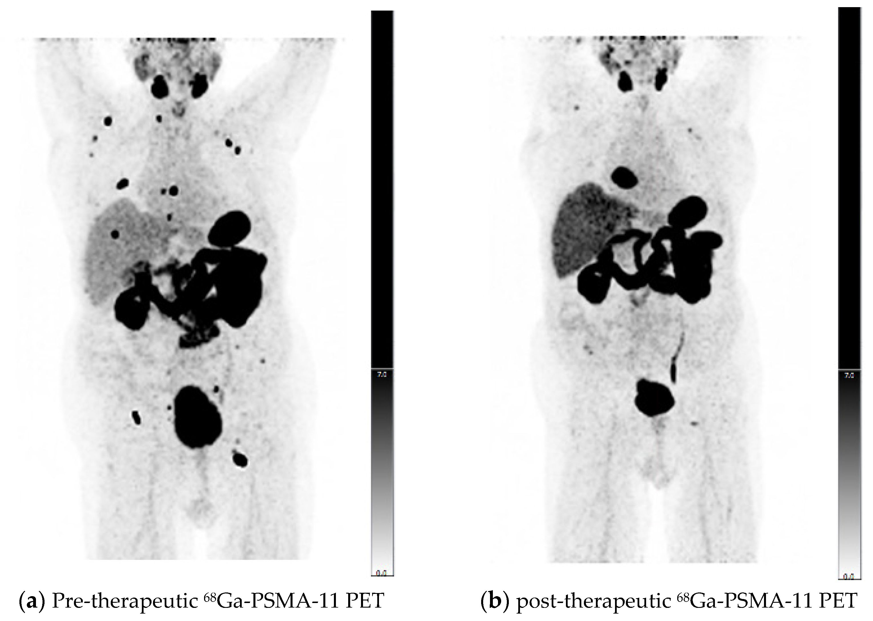 Diagnostics 11 00428 g003
