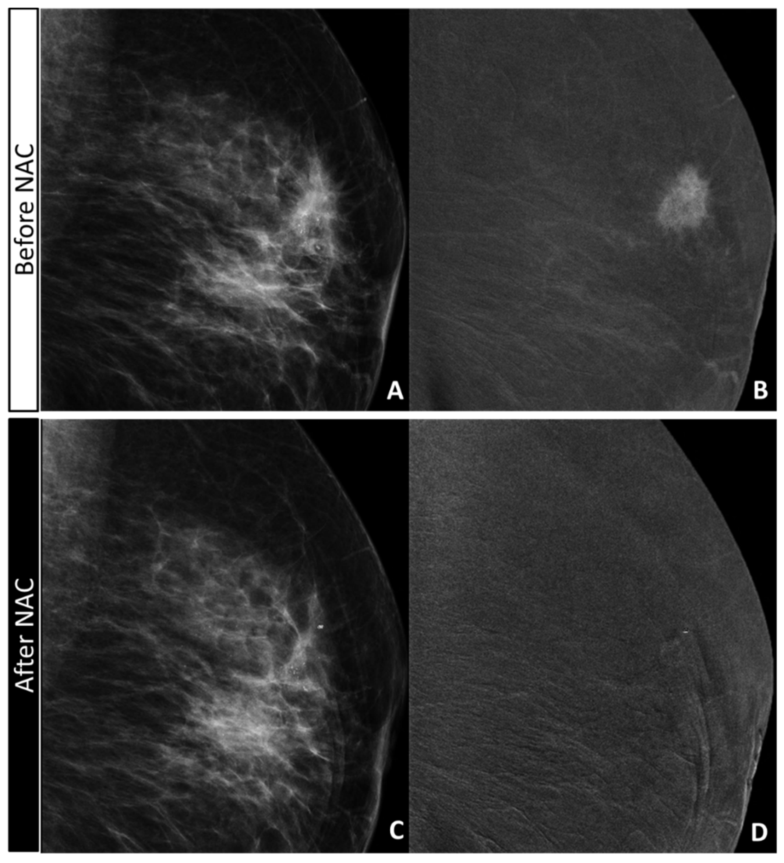 Diagnostics 11 00435 g005 Diagnostics 11 00435 g005