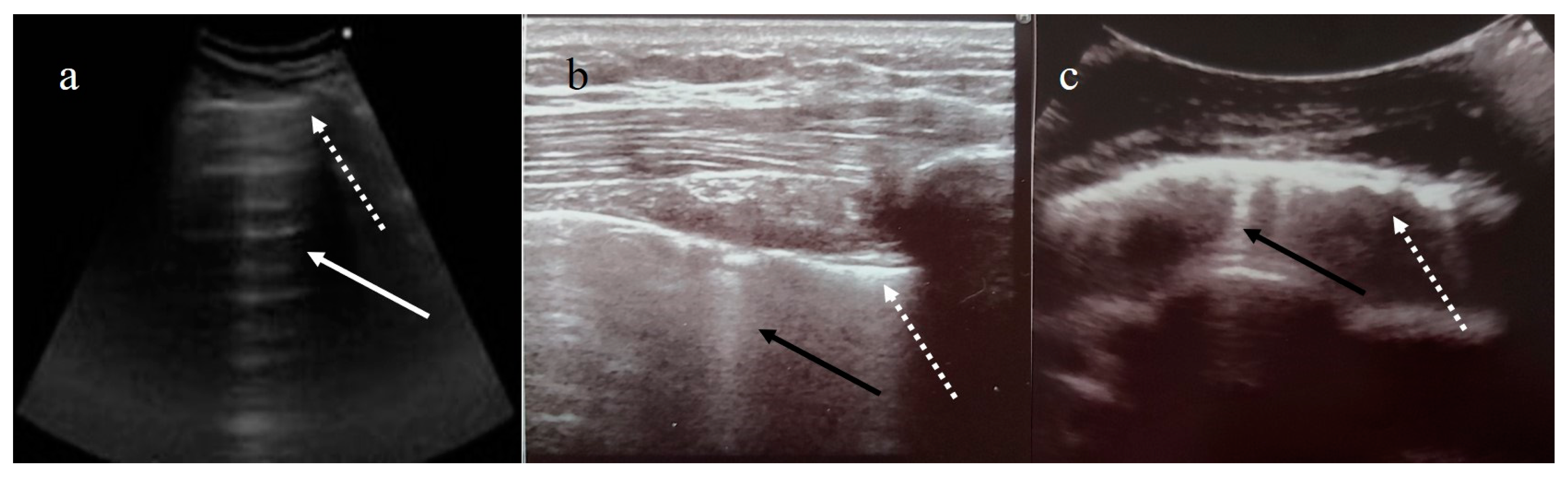 Diagnostics 11 00437 g003 Diagnostics 11 00437 g003