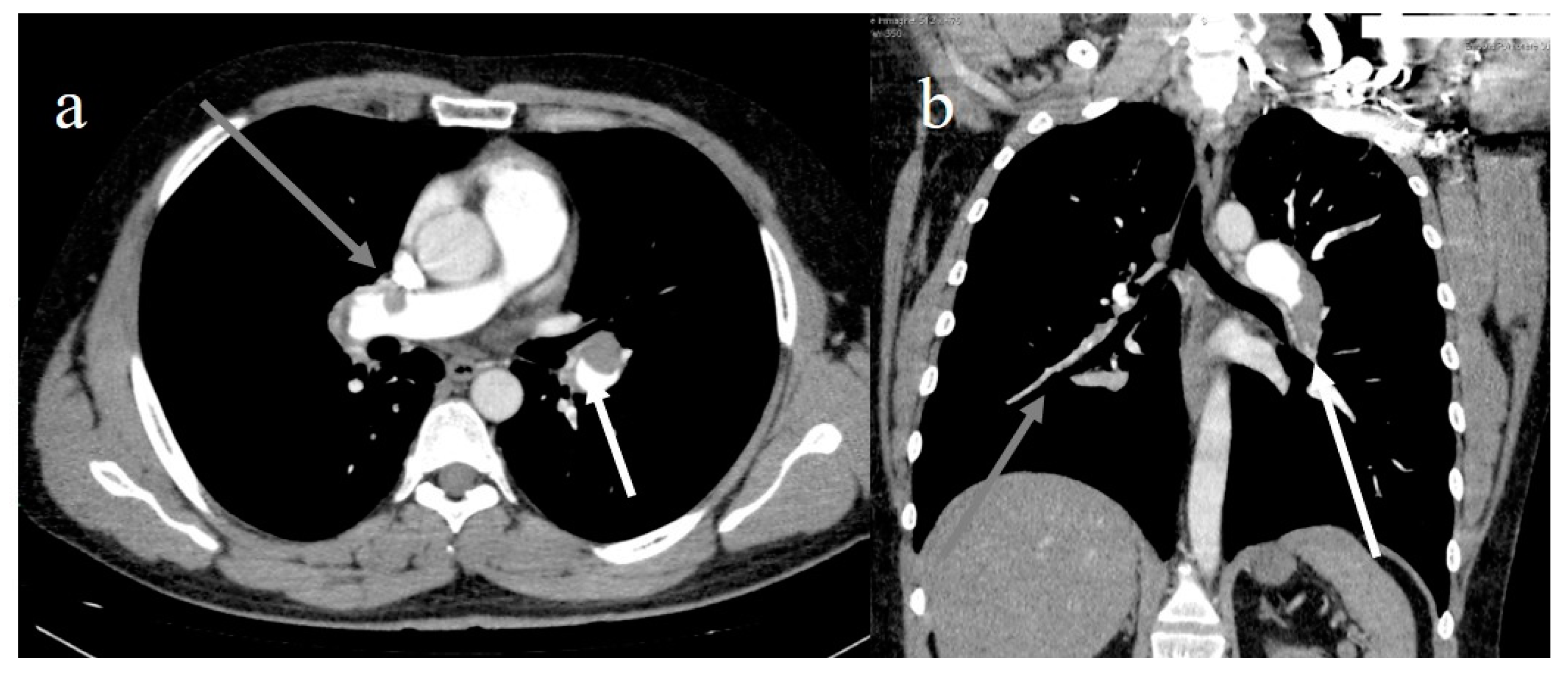 Diagnostics 11 00437 g006 Diagnostics 11 00437 g006