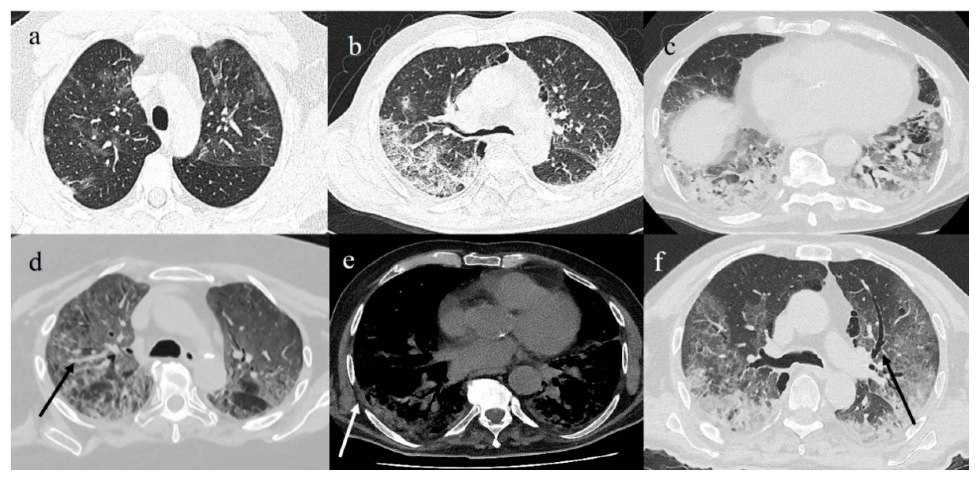 Diagnostics 11 00437 g007 Diagnostics 11 00437 g007