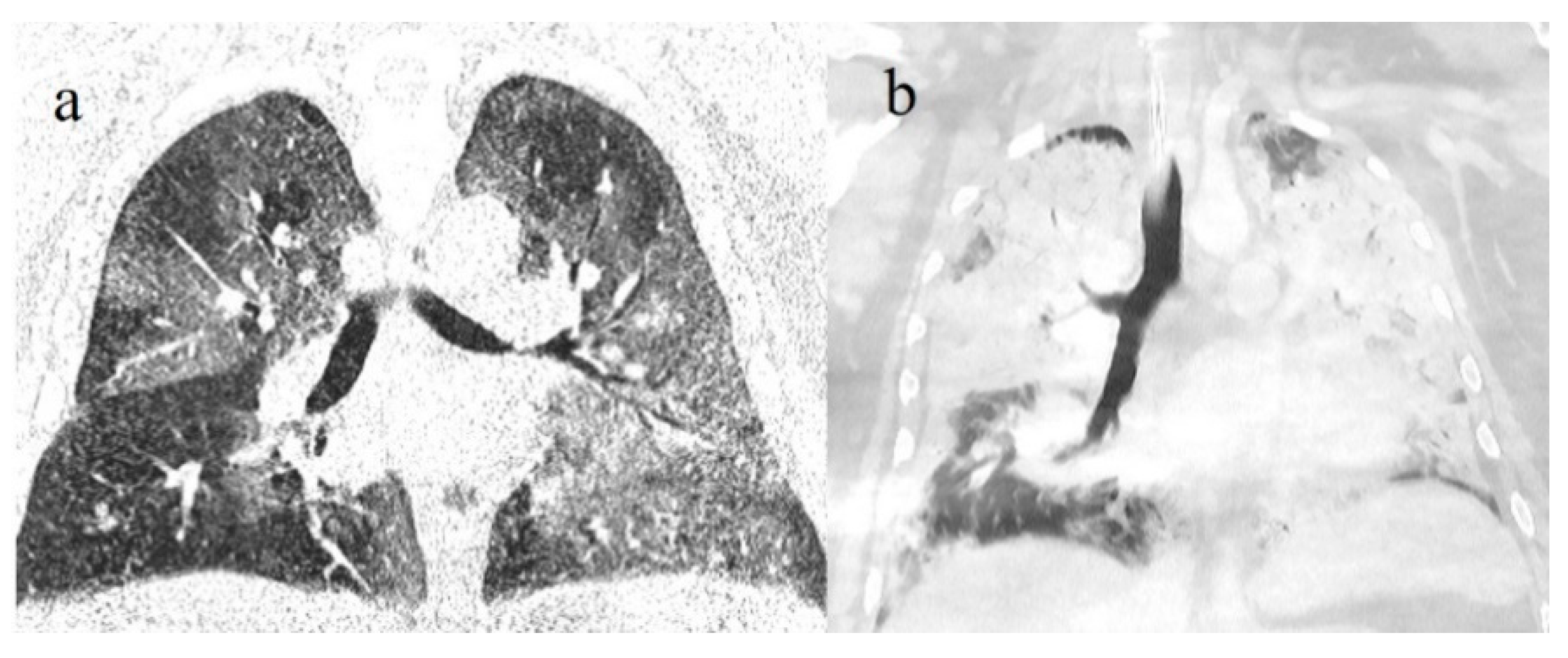 Diagnostics 11 00437 g011 Diagnostics 11 00437 g011
