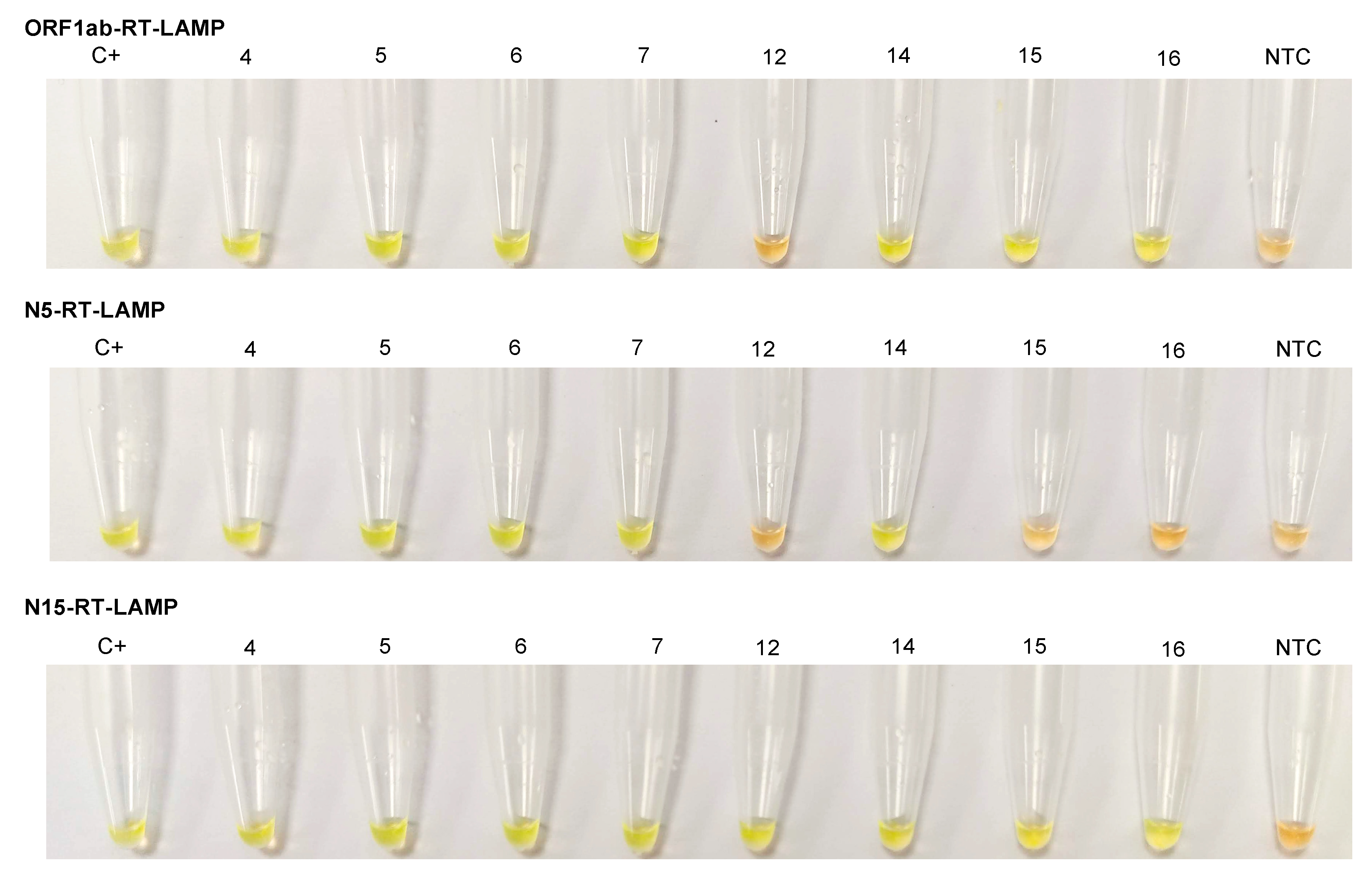 Diagnostics 11 00438 g005 Diagnostics 11 00438 g005