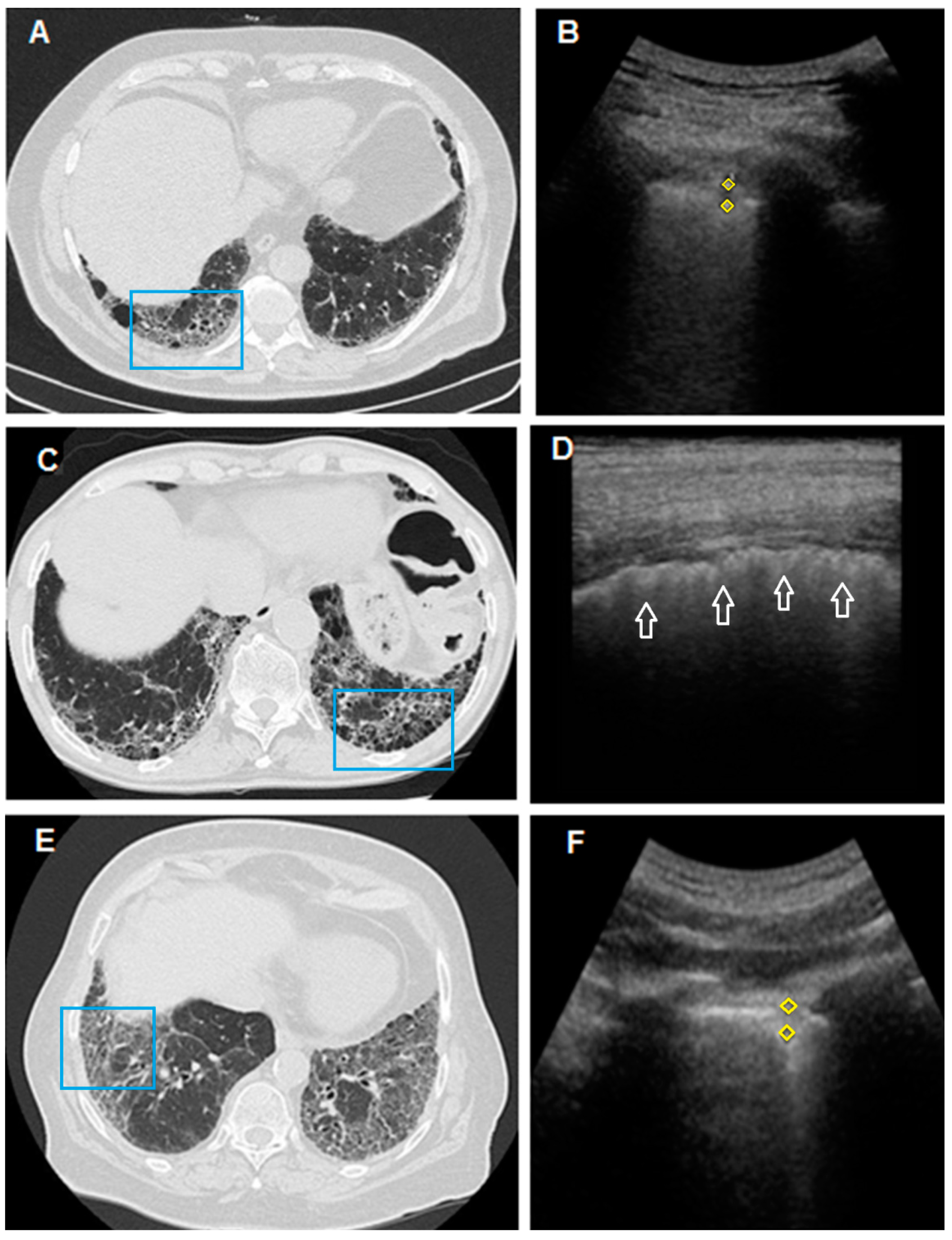 Diagnostics 11 00439 g004