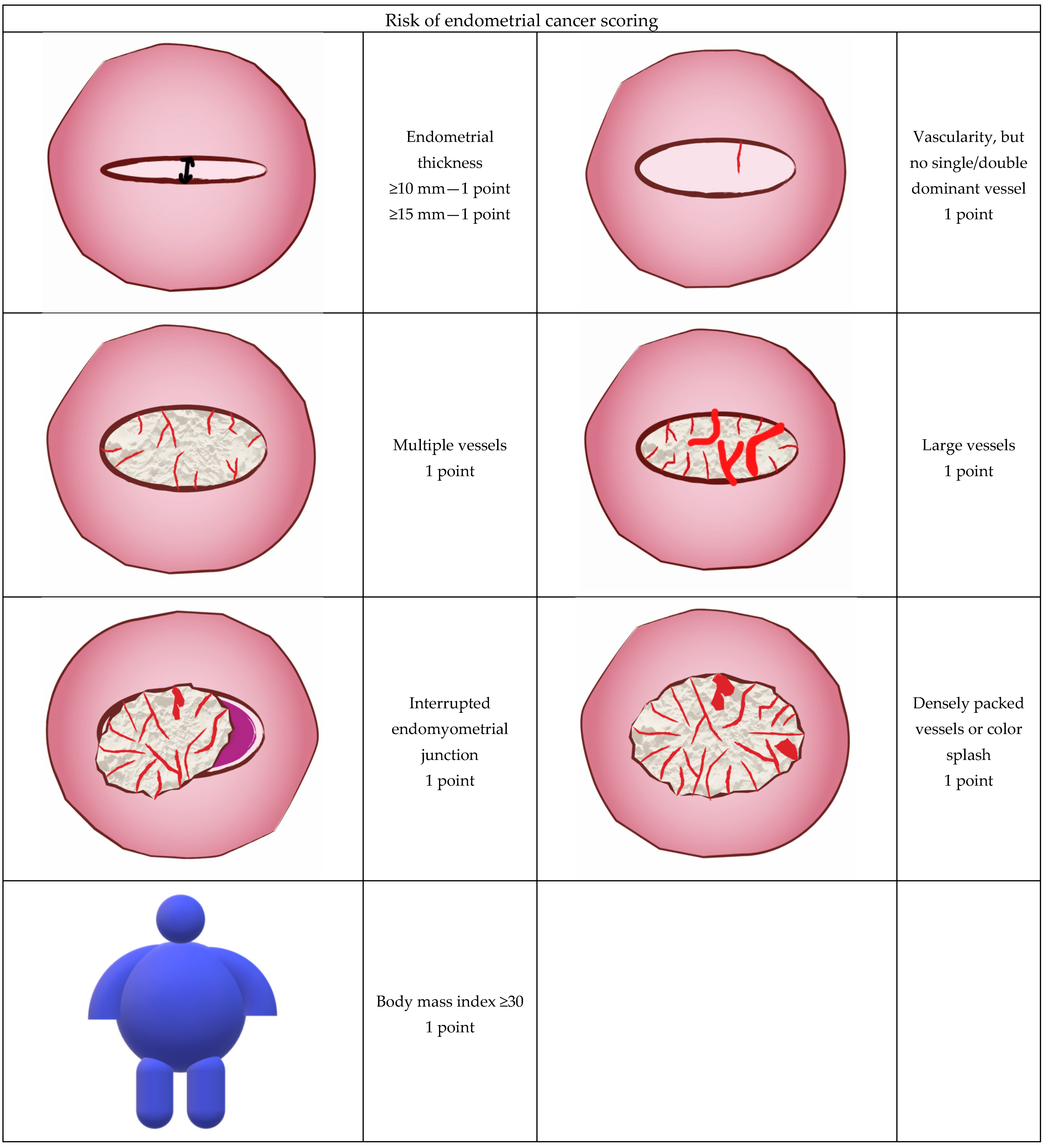 Diagnostics | Free Full-Text | Risk Assessment of Endometrial Hyperplasia  or Endometrial Cancer with Simplified Ultrasound-Based Scoring Systems