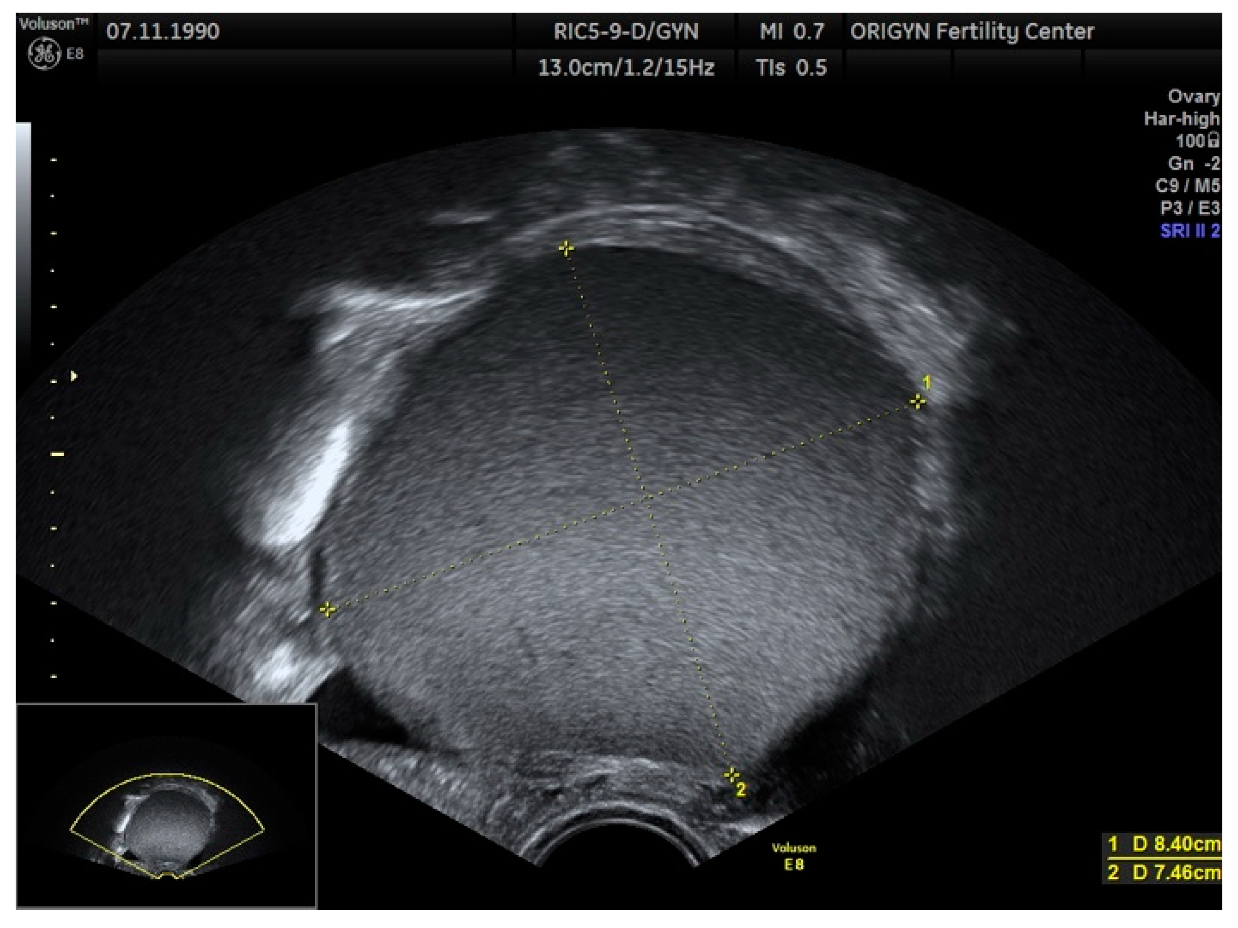 Diagnostics 11 00444 g001 Diagnostics 11 00444 g001