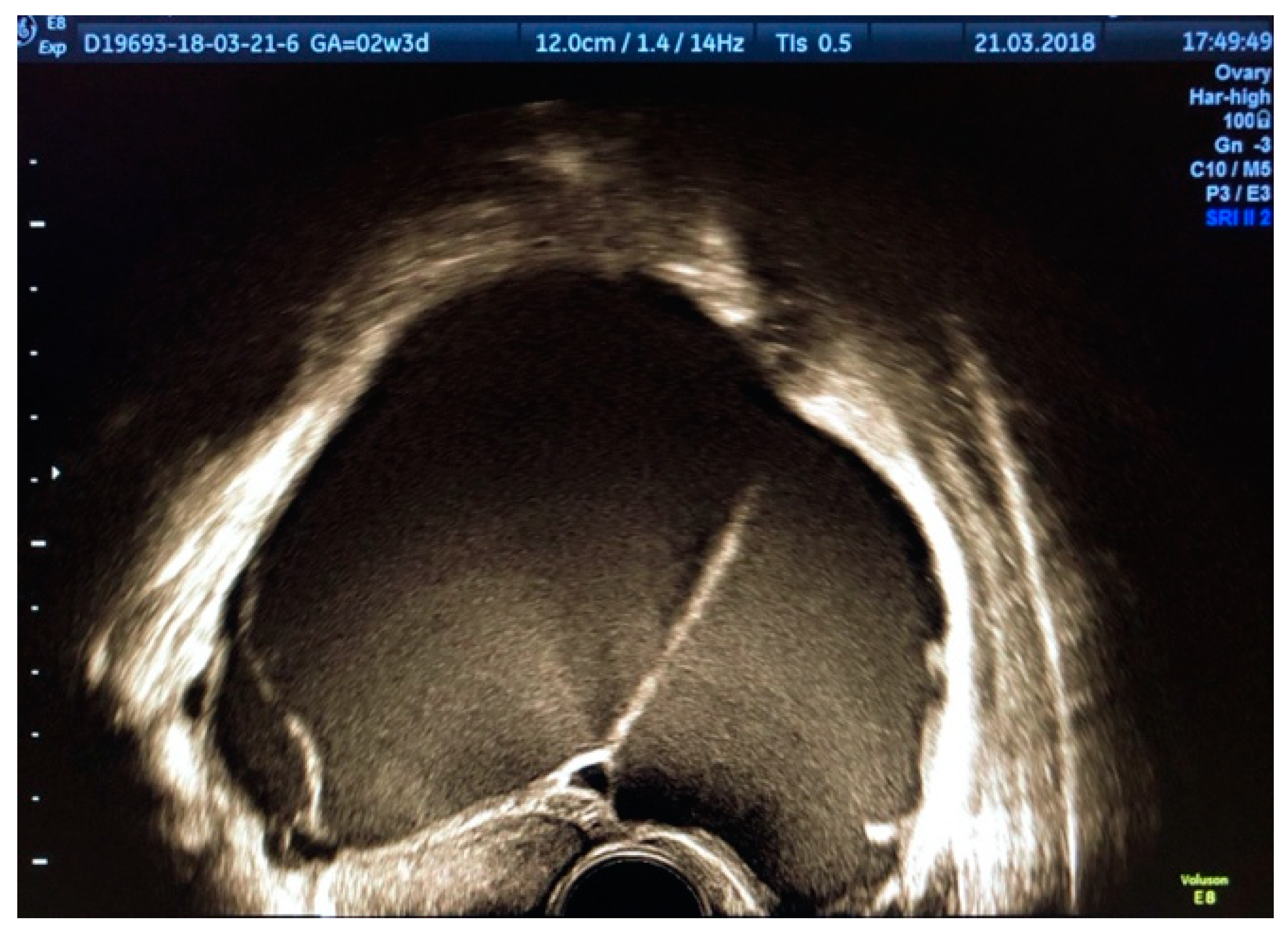 Diagnostics 11 00444 g002 Diagnostics 11 00444 g002