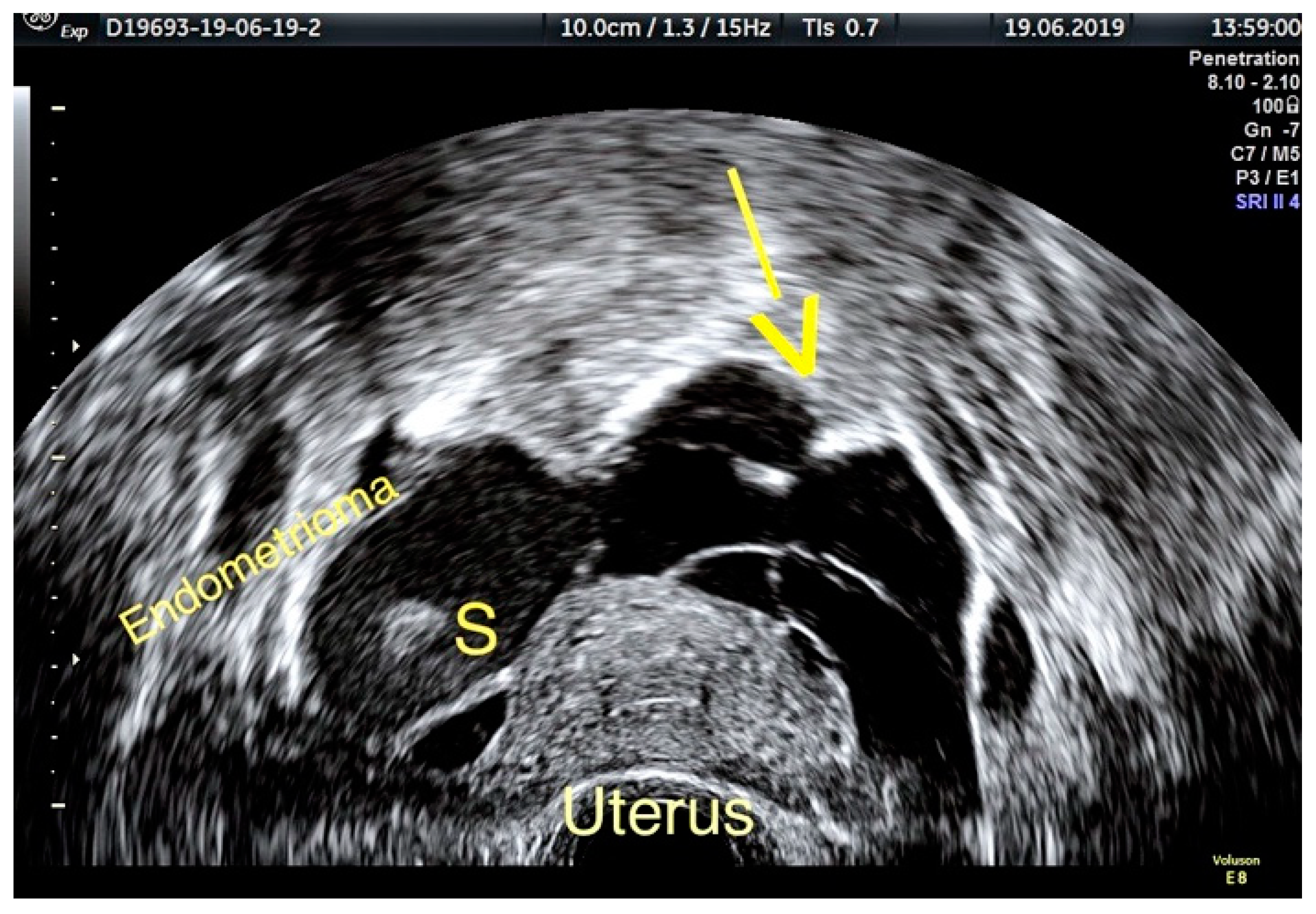 Diagnostics 11 00444 g003 Diagnostics 11 00444 g003