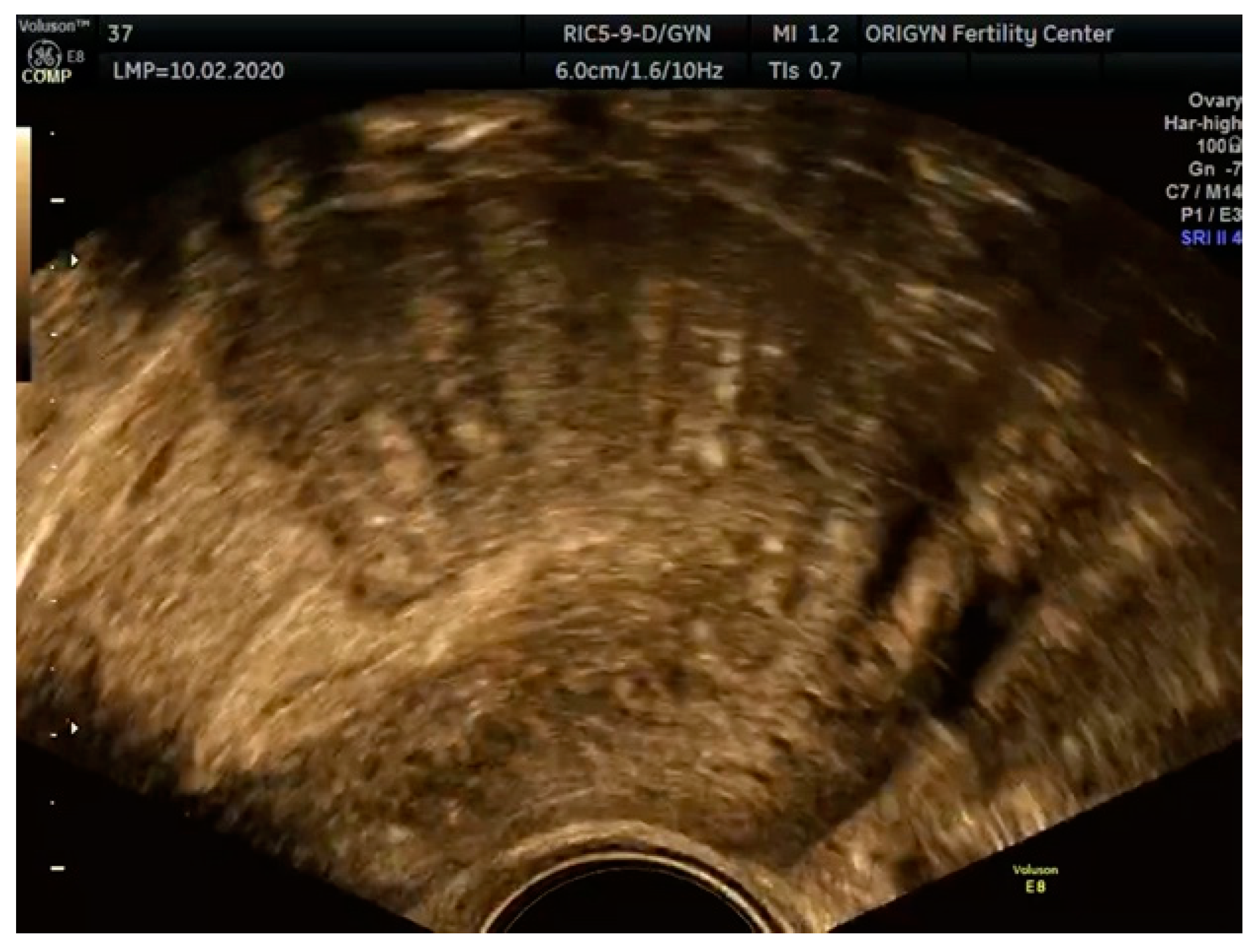 Diagnostics 11 00444 g006 Diagnostics 11 00444 g006